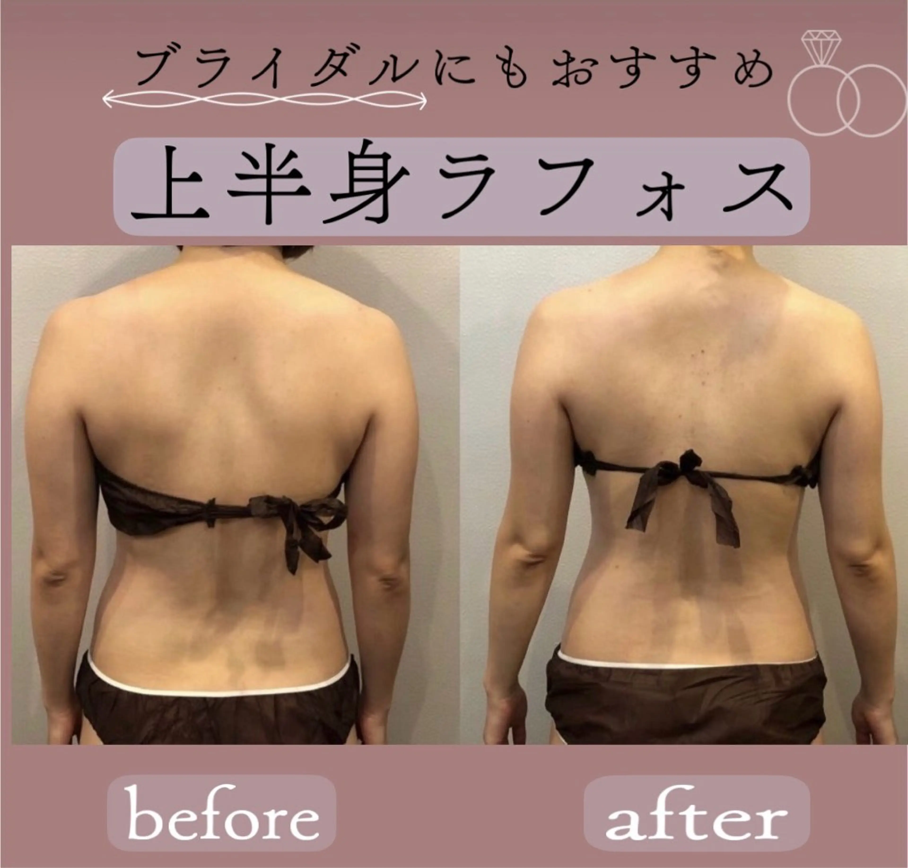 エステ Total beauty salon  Brilliant所属・ROCO yuiの眉毛・アイブロウイメージ