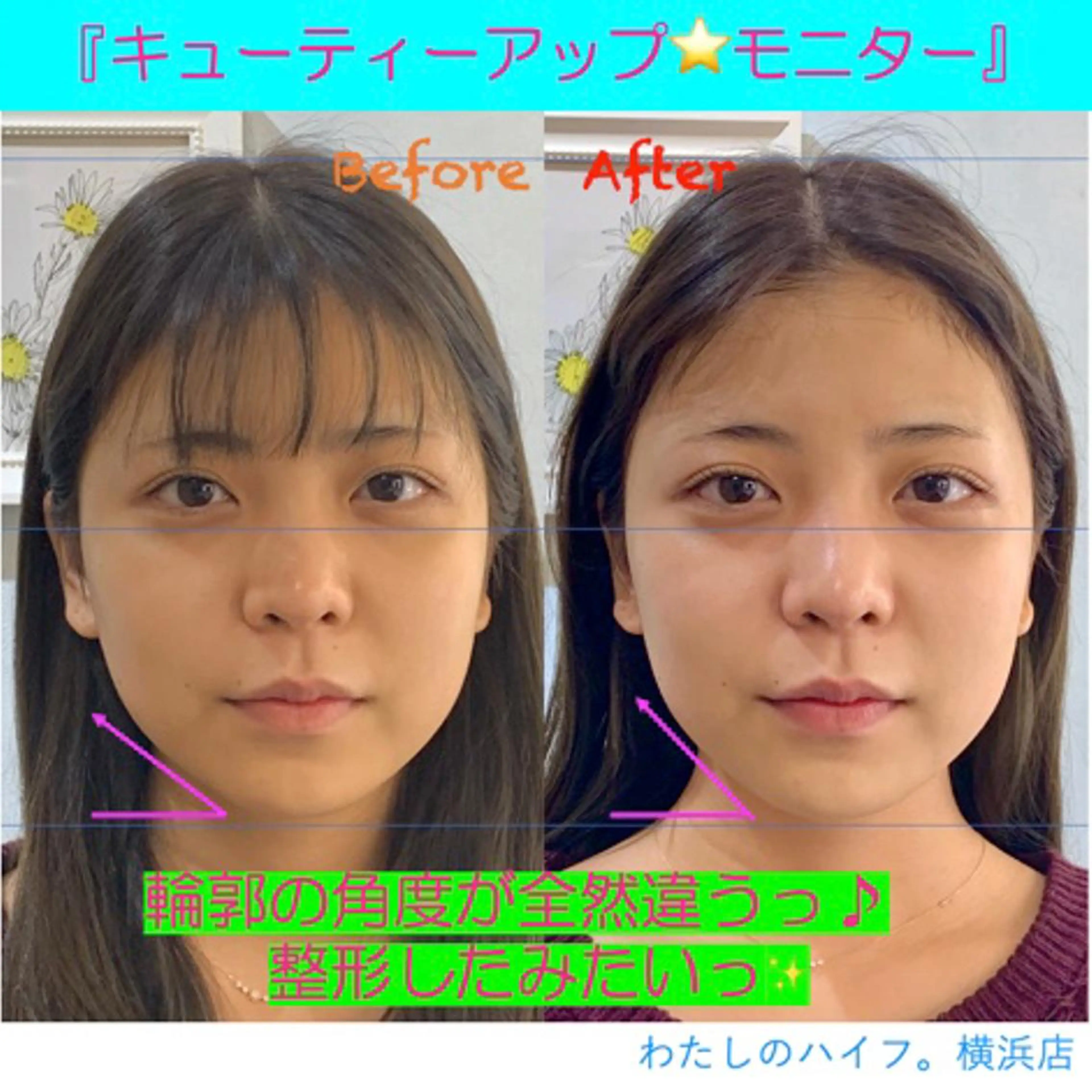 小顔美肌&痩身ｻﾛﾝ My Timeのエステ・リラクイメージ