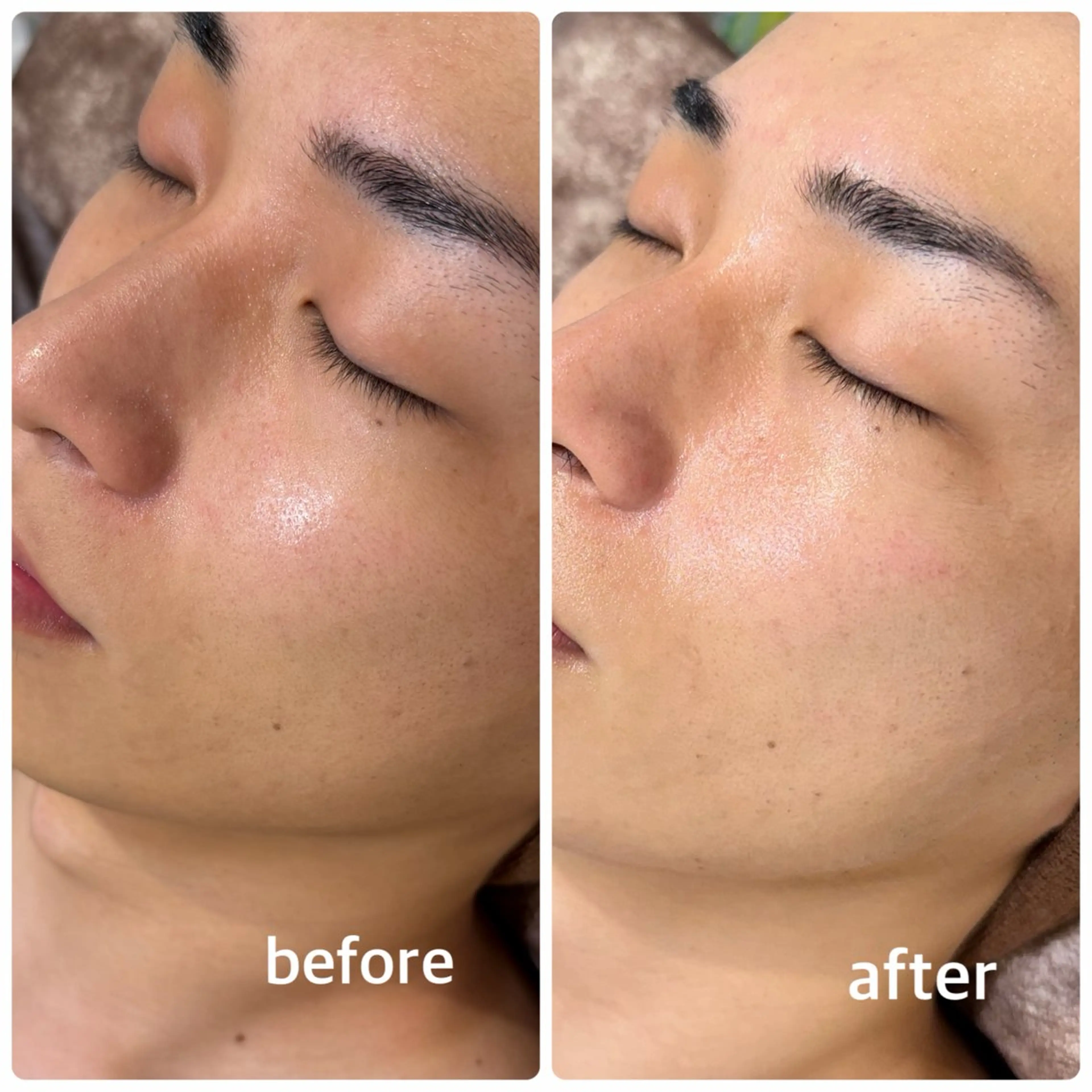 メンズ その他 今西 彩夢のエステ・リラクイメージ