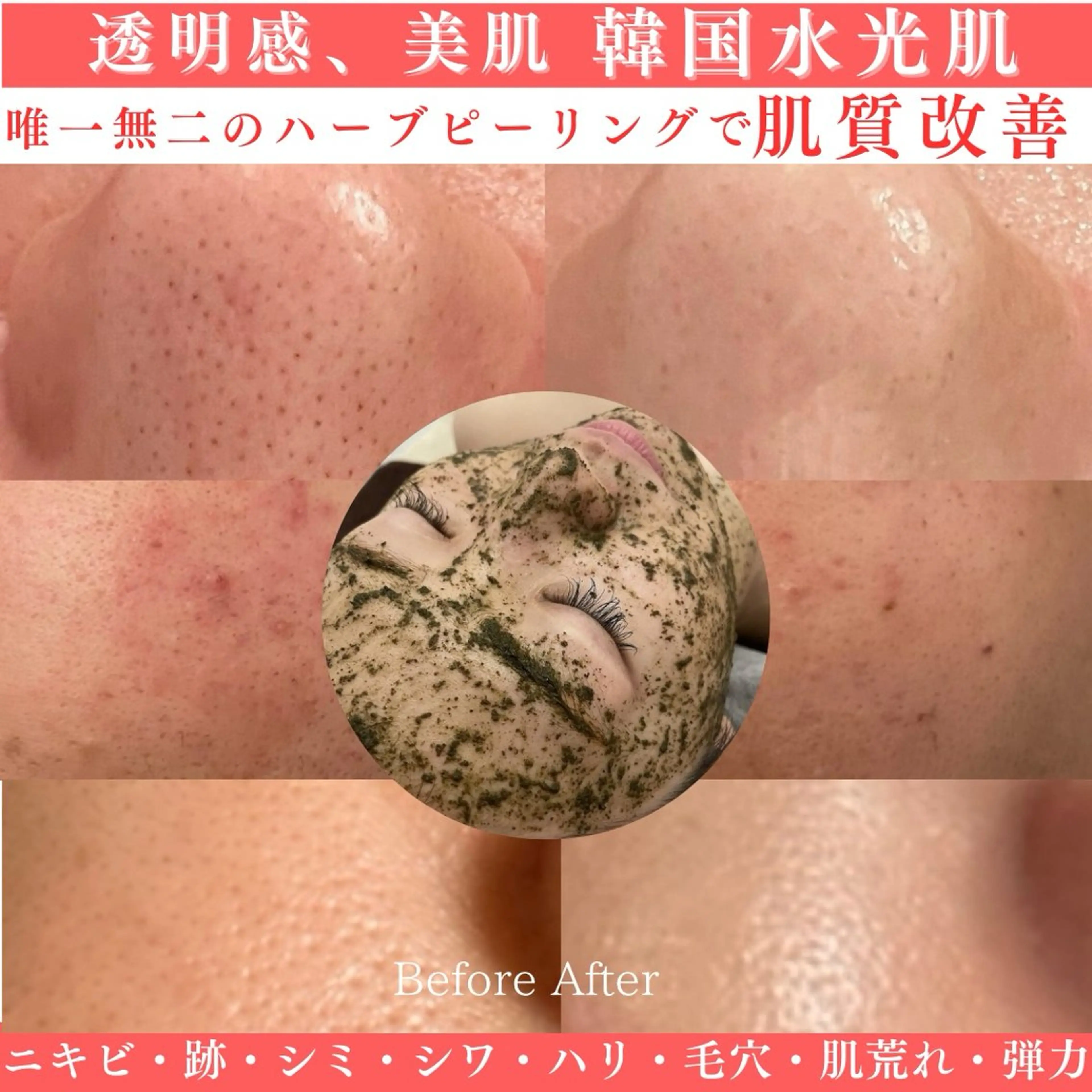 話題のREVIハーブピーリングの写真