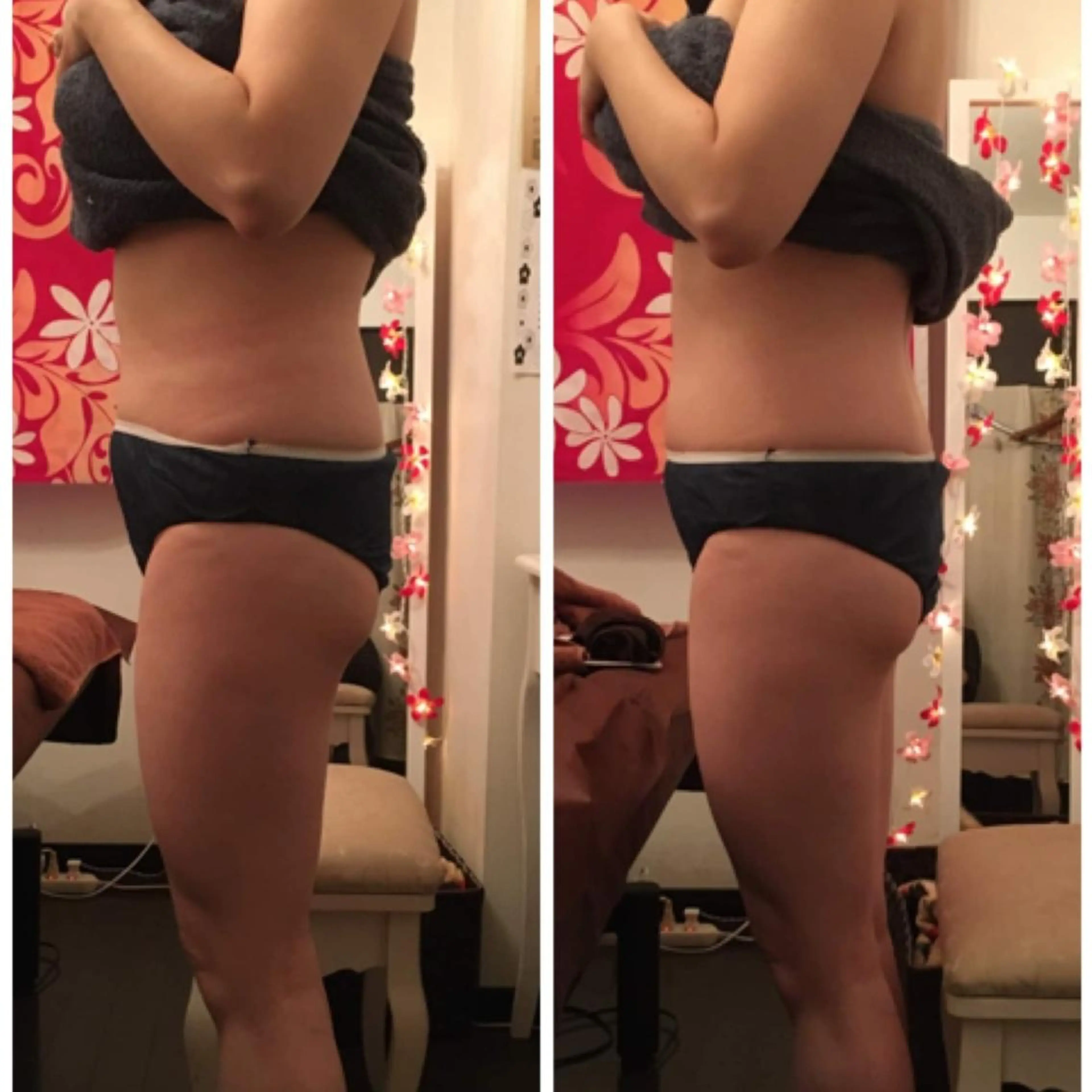 地域最安！リバウンドしずらい【切らない脂肪吸引と言われる】最新式次世代痩身マシーンライポソニックスで脂肪撃退の写真