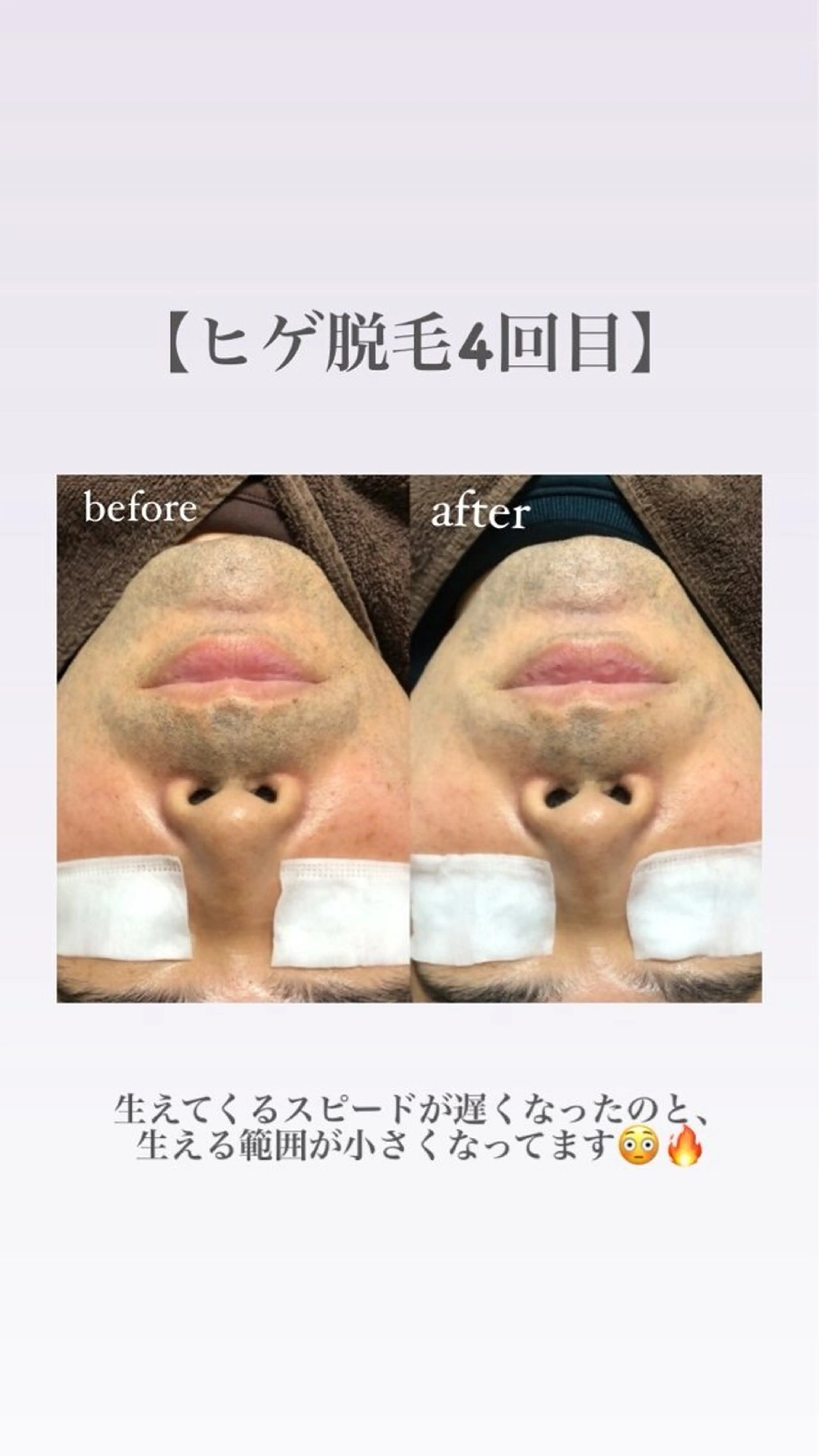 LANA所属・エステサロン LANA.のエステ・リラクイメージ