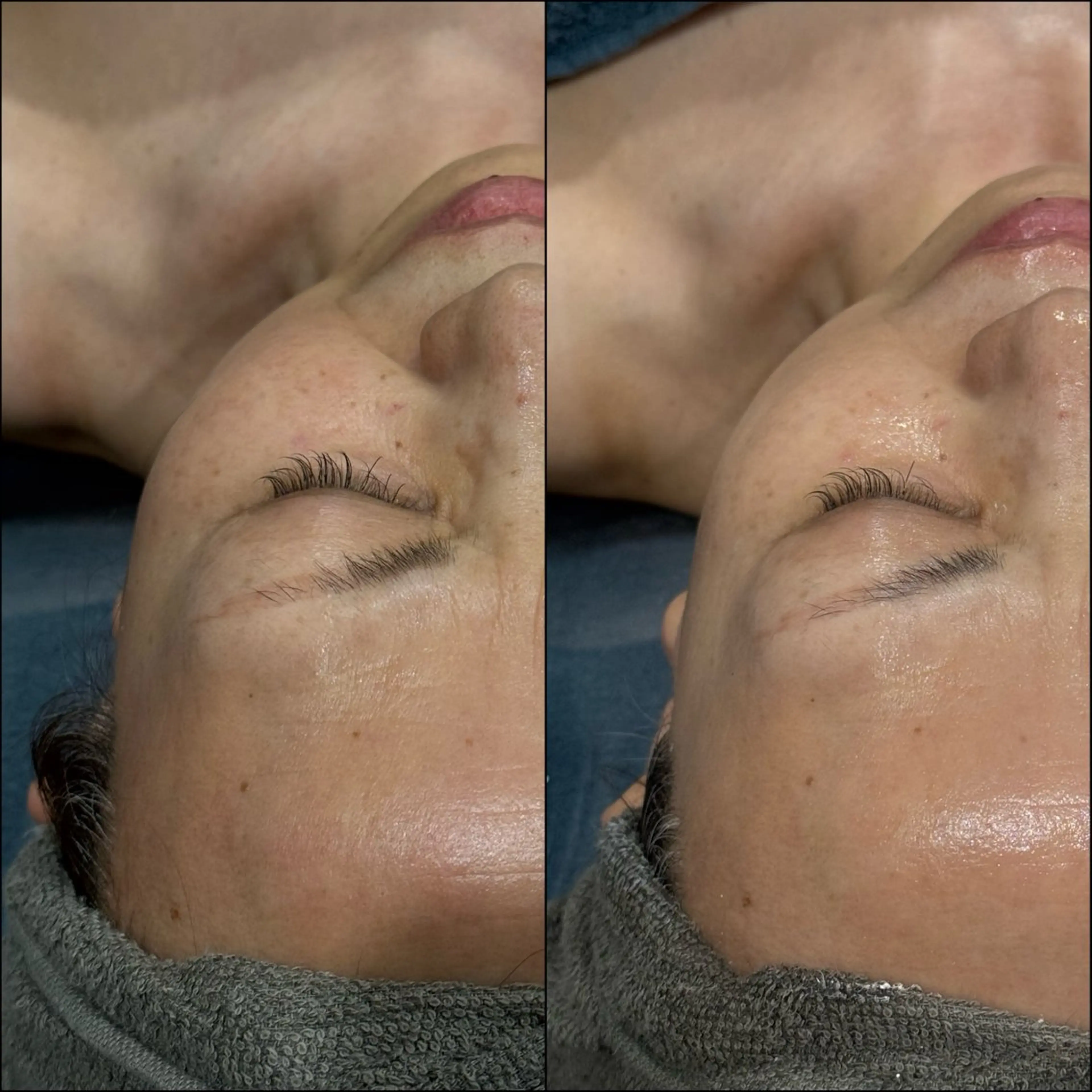 エステ LiZA エステティックサロンのエステ・リラクイメージ