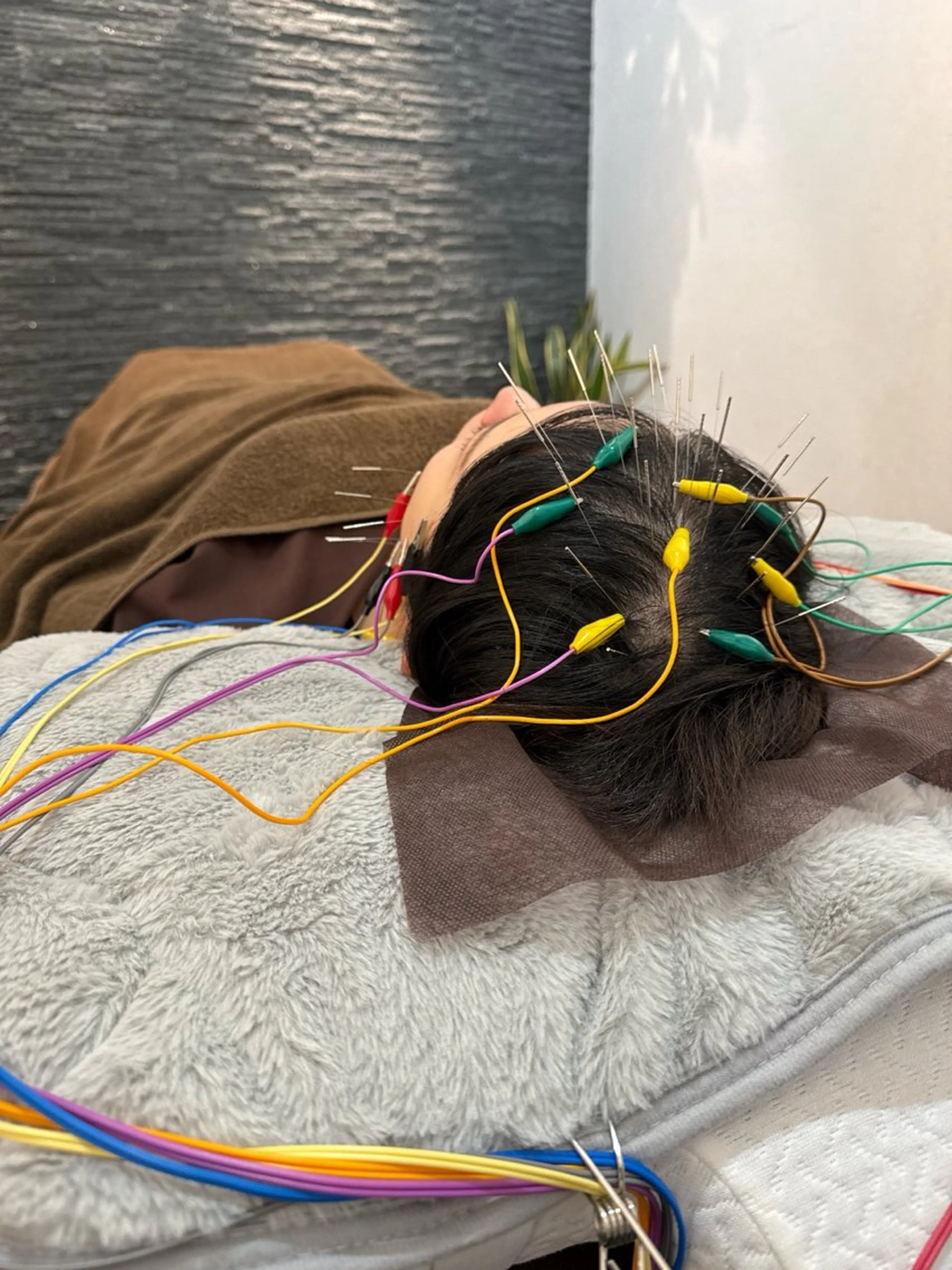 その他 美容鍼灸整体サロンBeauJu所属・小顔矯/美容鍼/鍼灸 BeauJuのその他イメージ