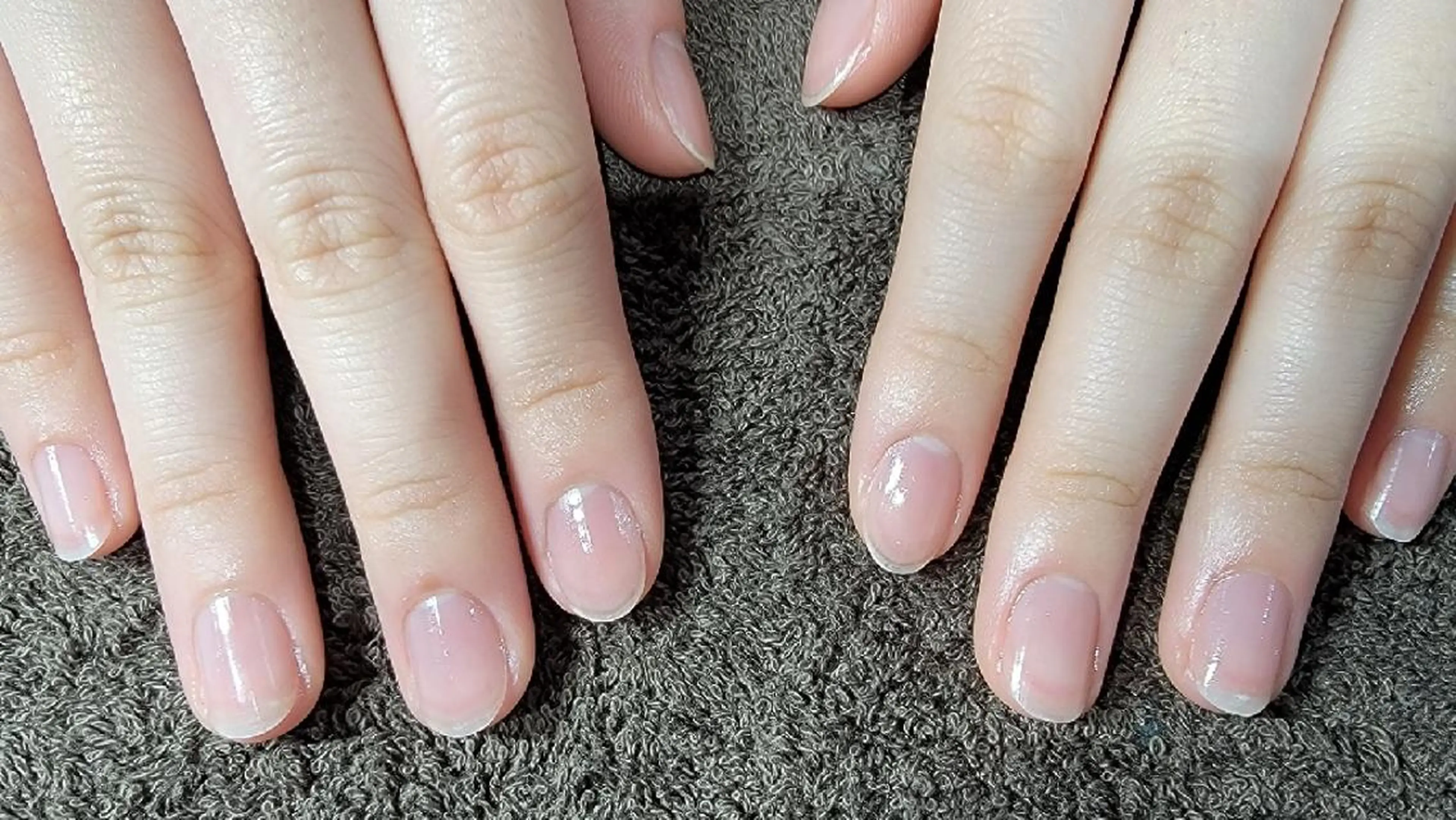 ネイル ネイル&巻き爪サロン 　AKnailのネイルデザイン