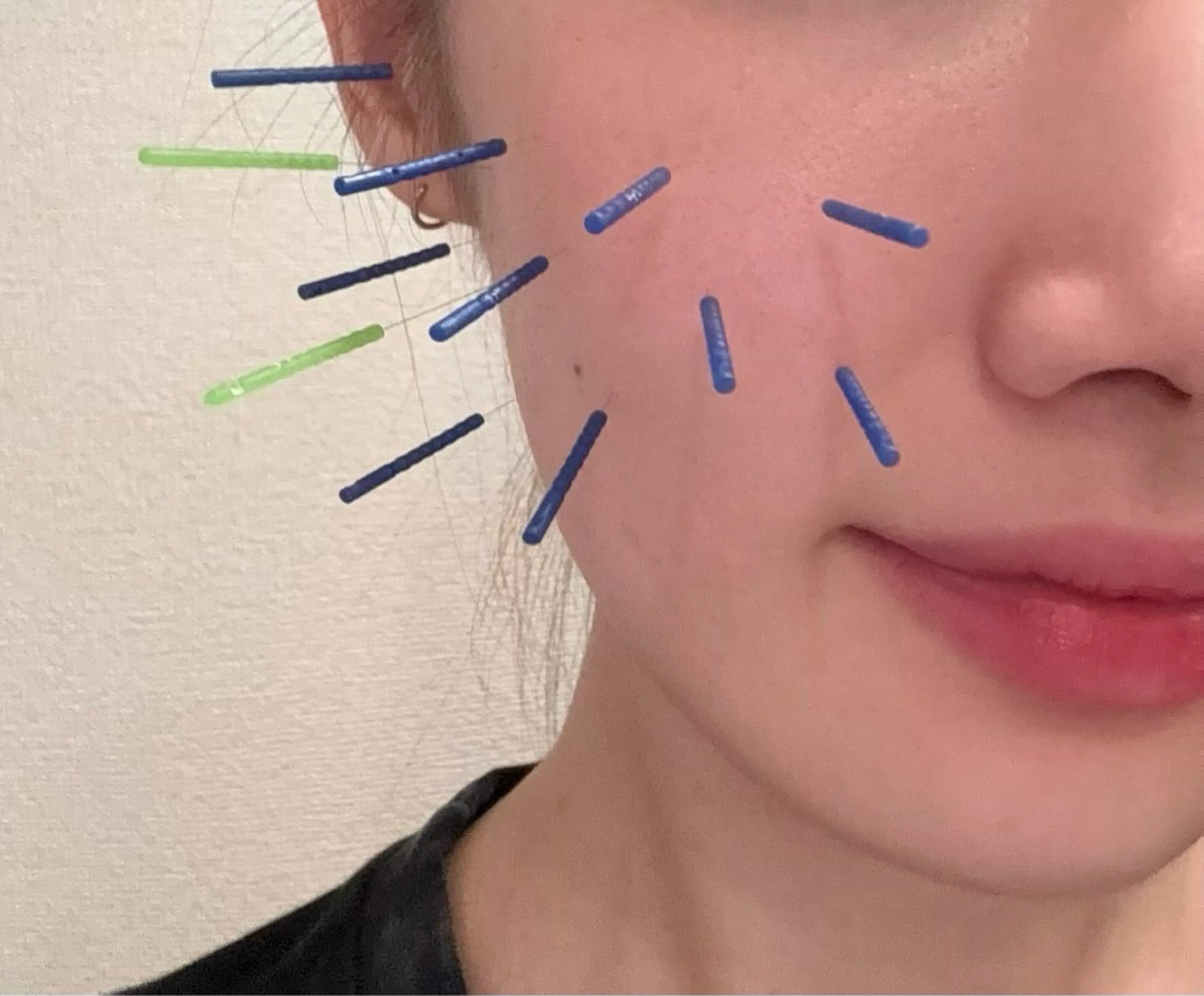 Beauty Salon lau　大山店所属・美容鍼(lau) Maiのエステ・リラクイメージ