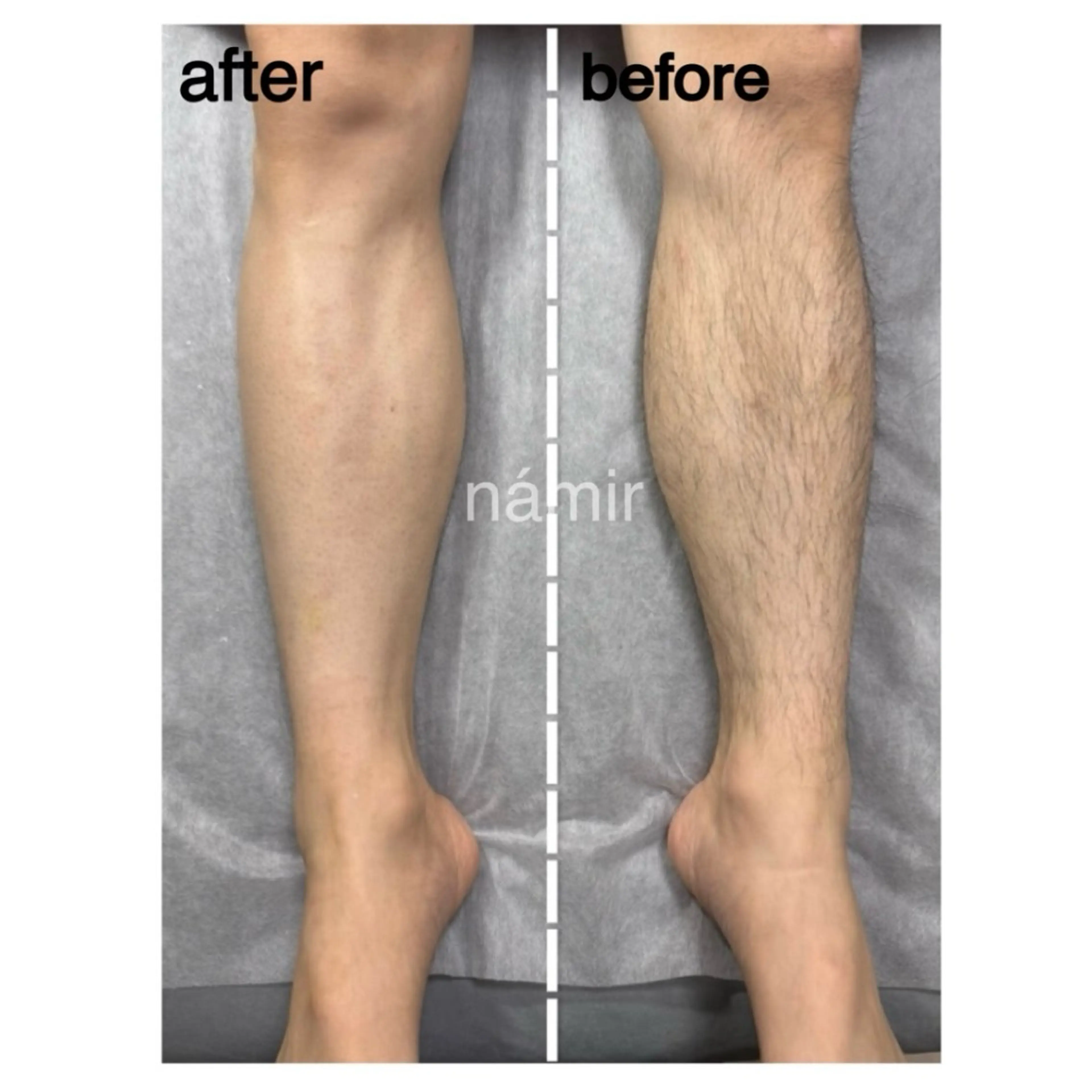 メンズ ブラジリアンワックス+光脱毛専門店námir【ナミル】所属・ブラジリアンワックス &光脱毛námirのエステ・リラクイメージ