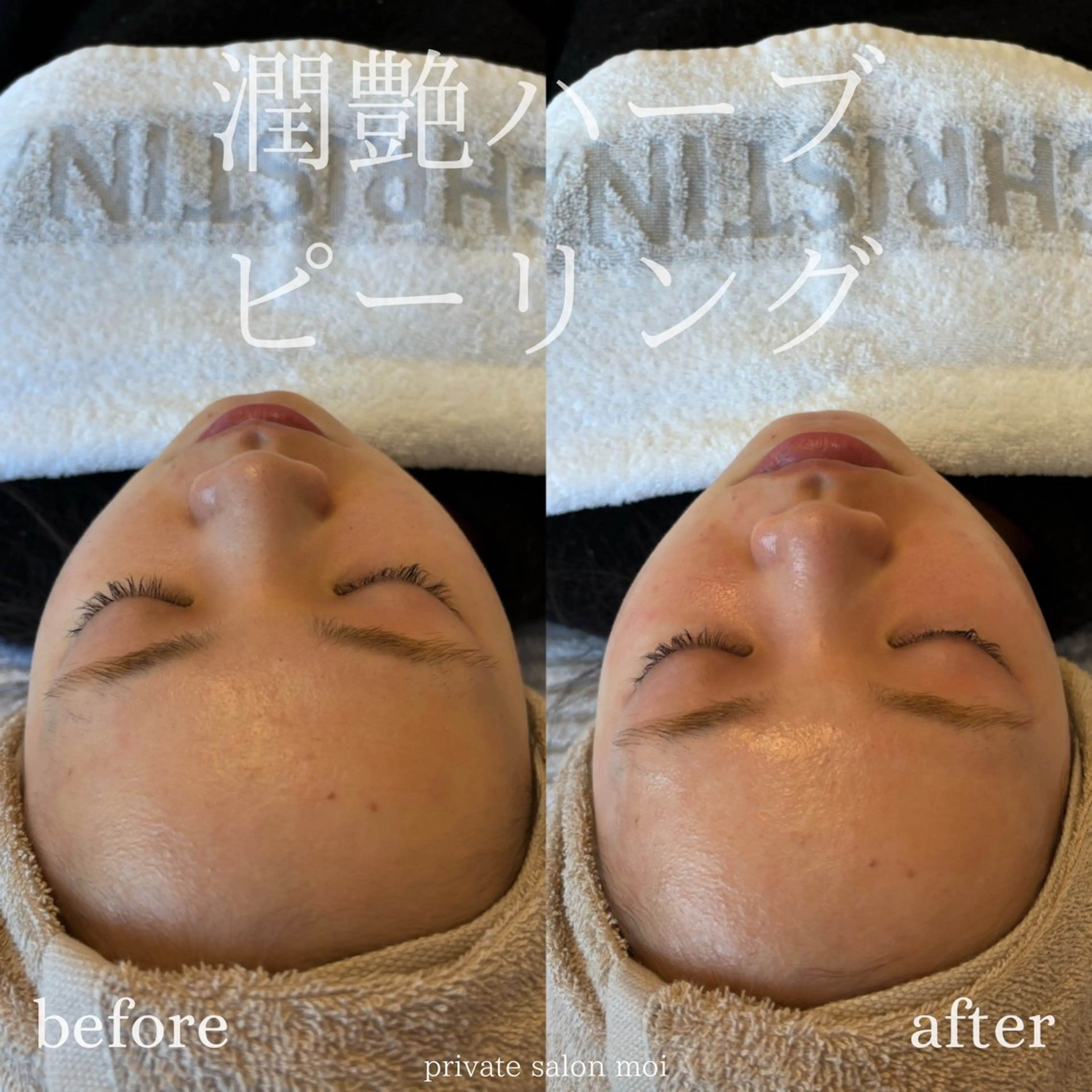 salon moi(モア)のエステ・リラクイメージ