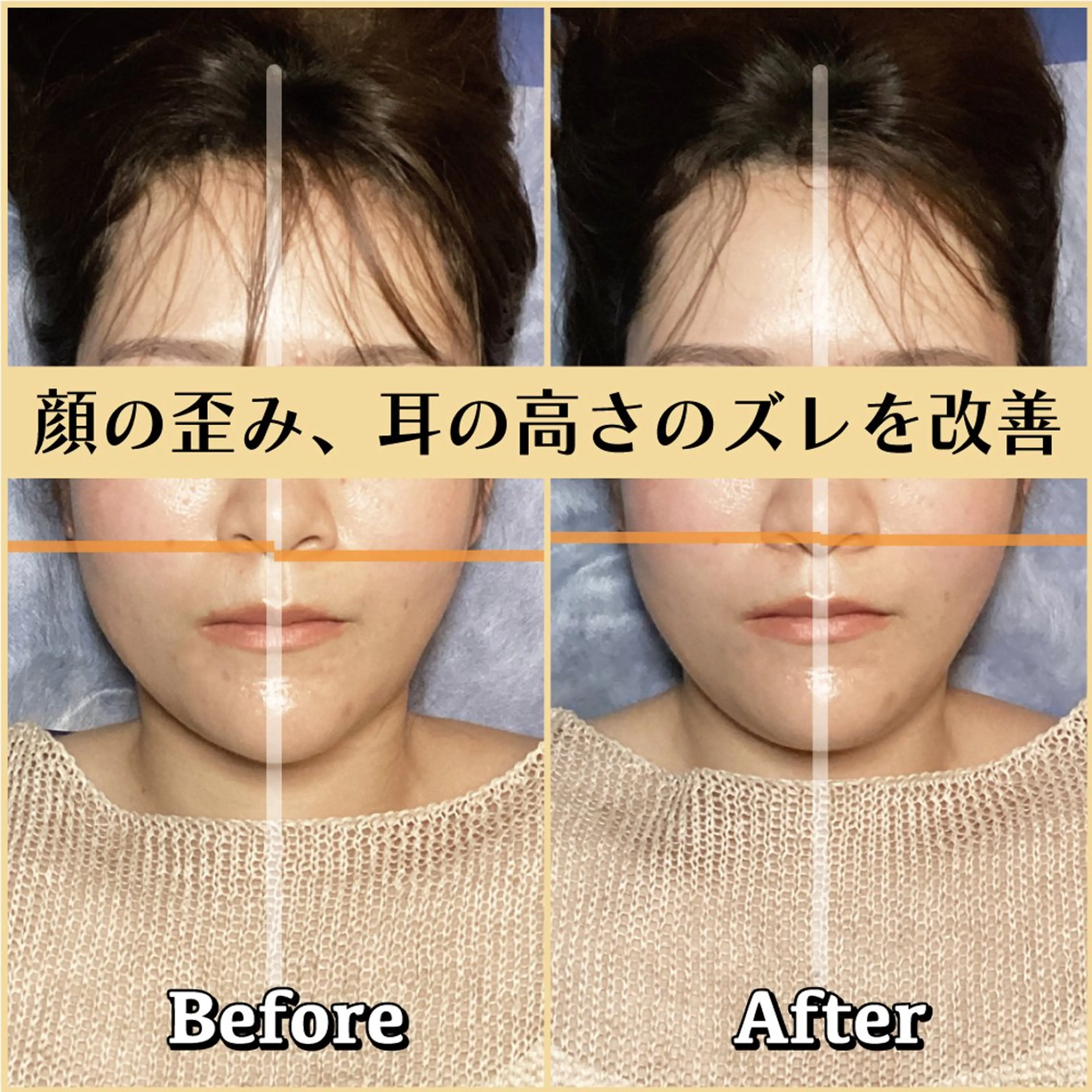 エステ リラク 歪み専門💫筋膜整体 はたやまきんま君💪のエステ・リラクイメージ