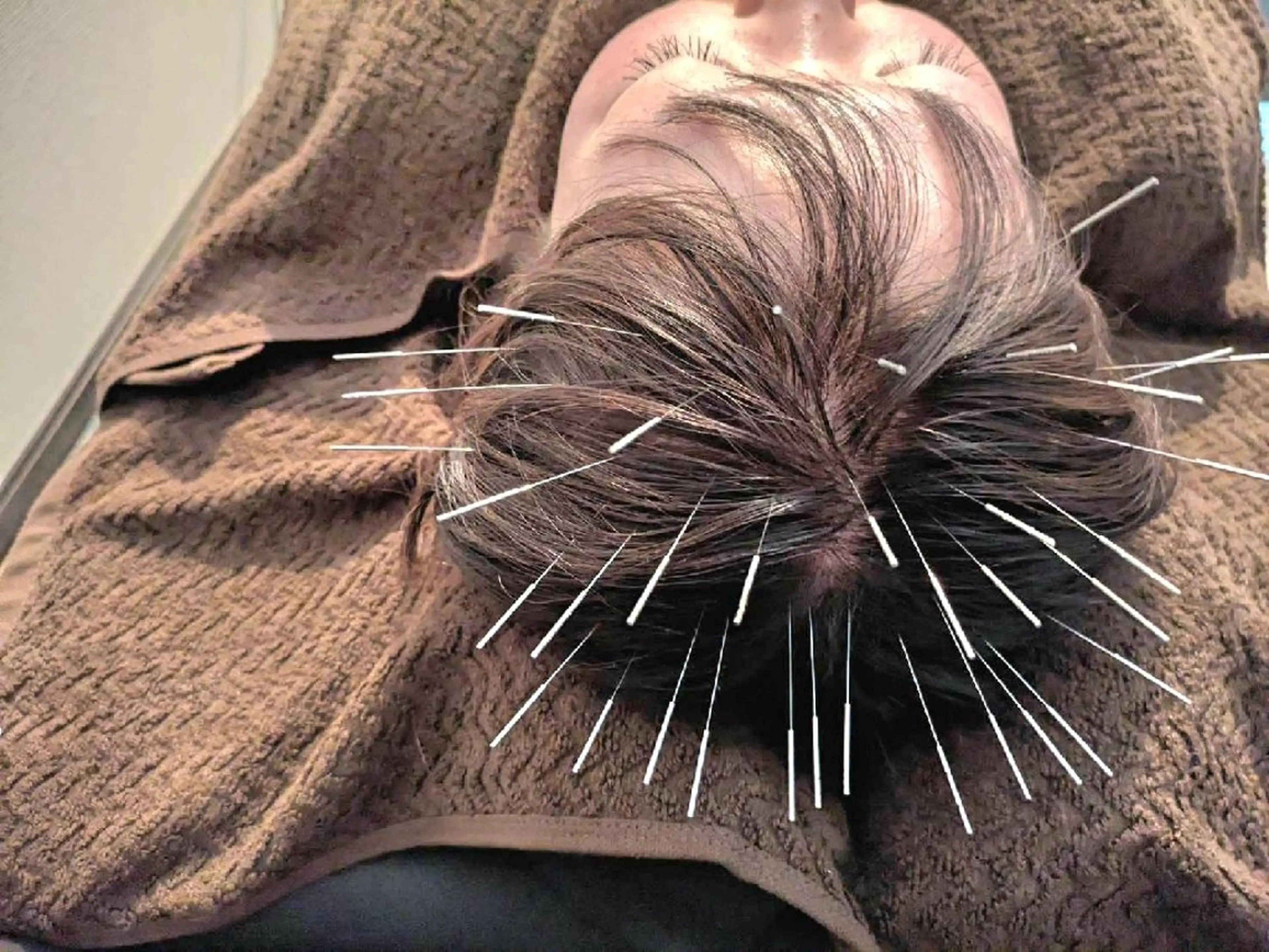 KANWA鍼灸院所属・KANWA 鍼灸院のエステ・リラクイメージ