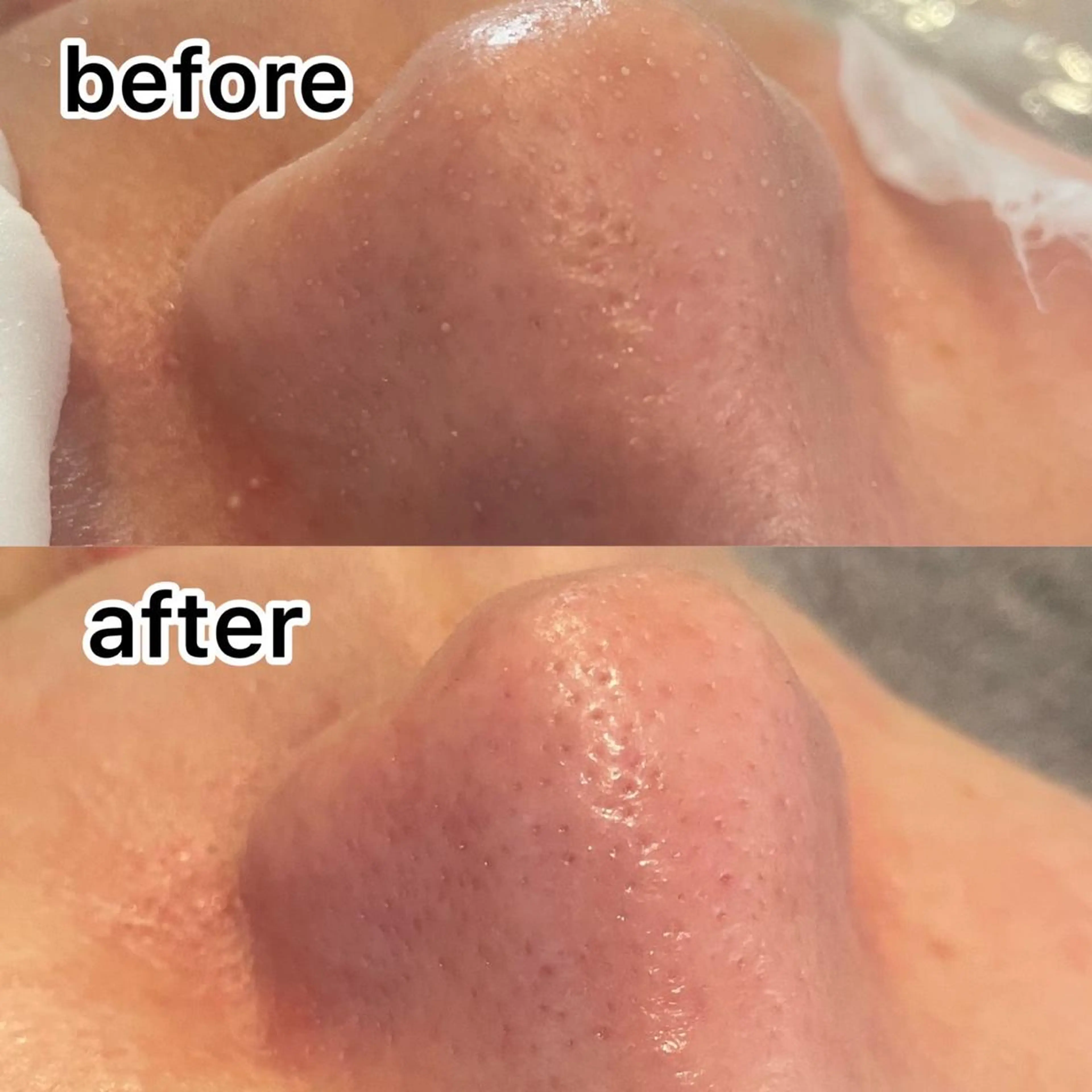 メンズ キッズ アイブロウ Amm所属・🏆艶肌ワックス🏆 ララピール✨Ammのエステ・リラクイメージ