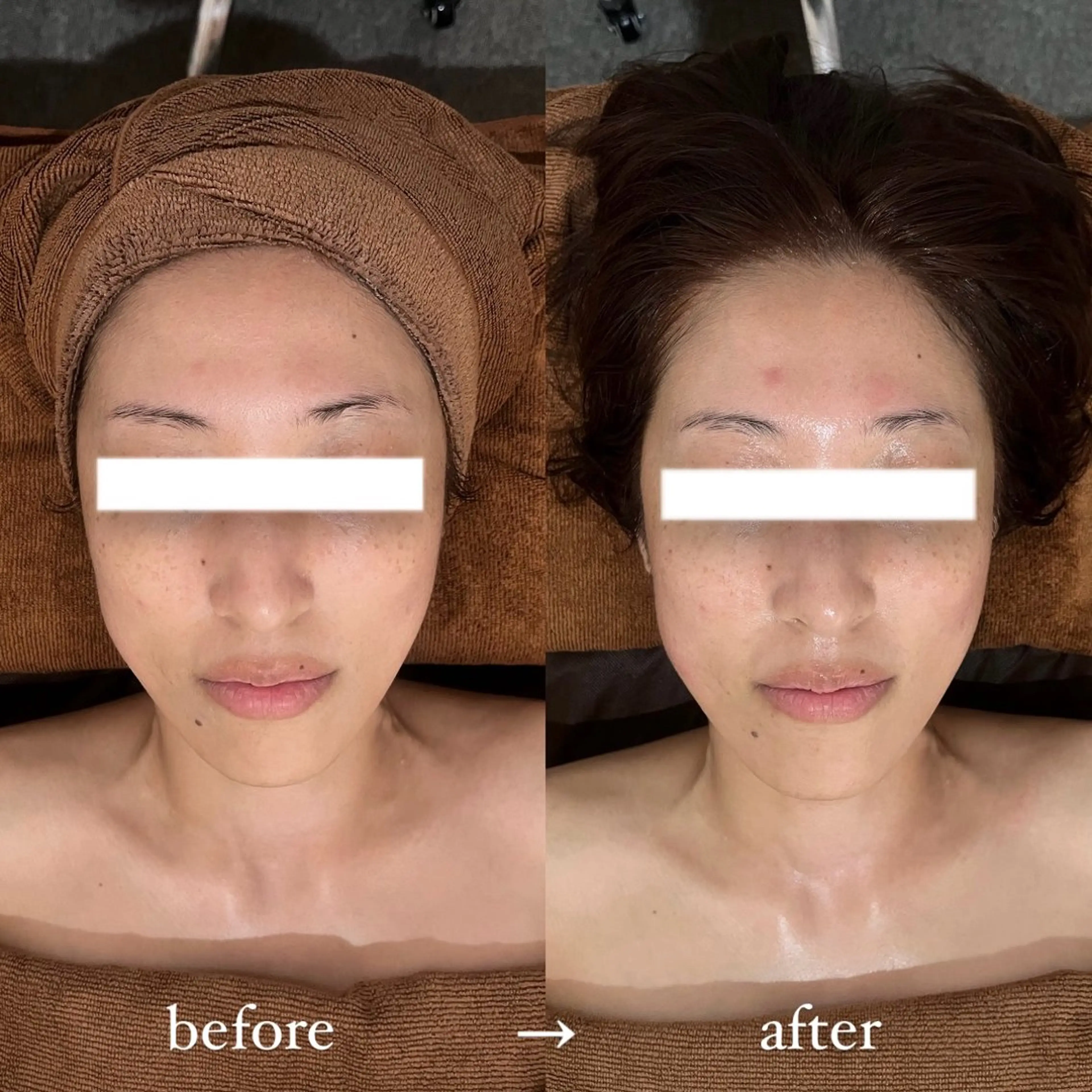 NOEL所属・フェイシャルエステ Utaiのエステ・リラクイメージ