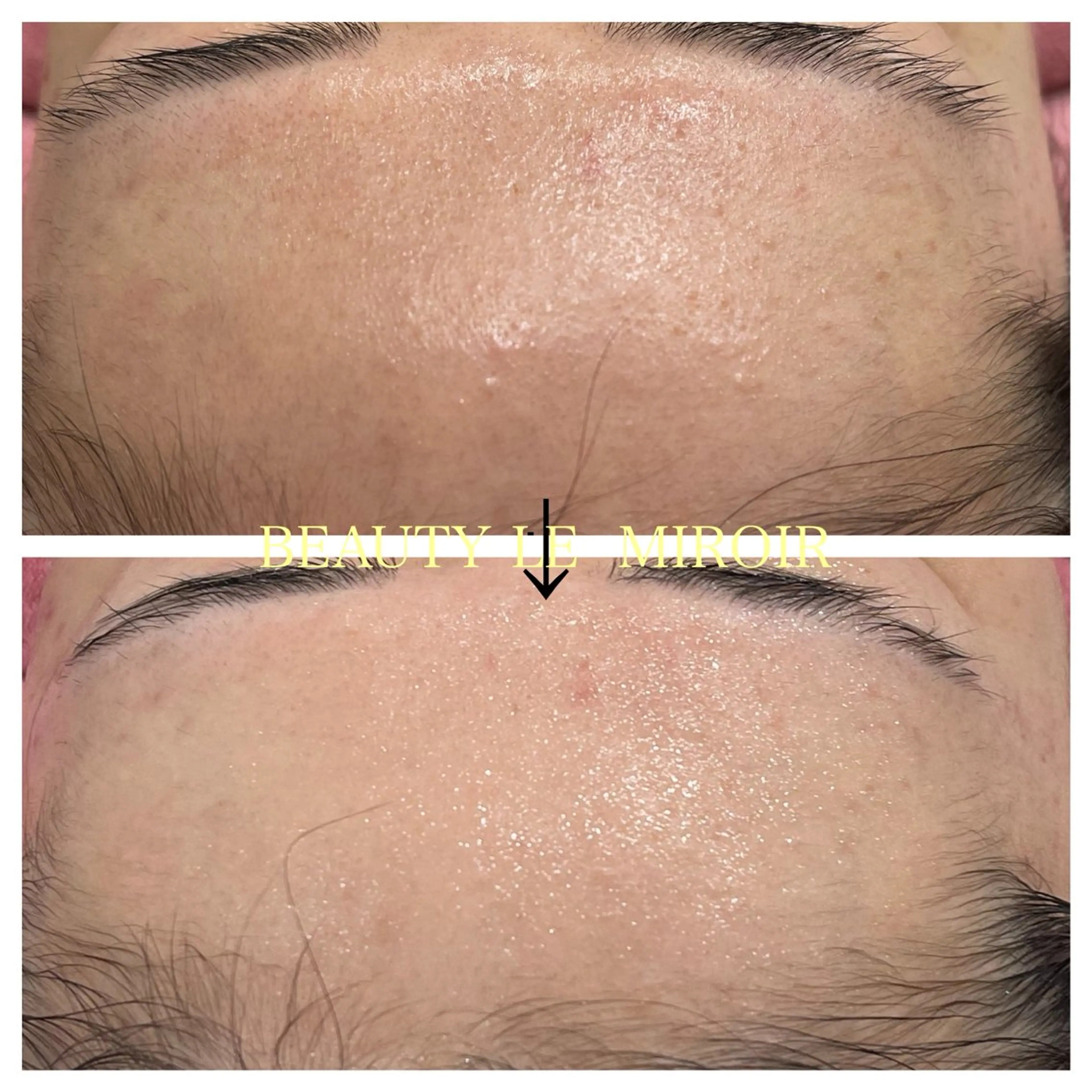 エステ ビューティー ミロワールのエステ・リラクイメージ