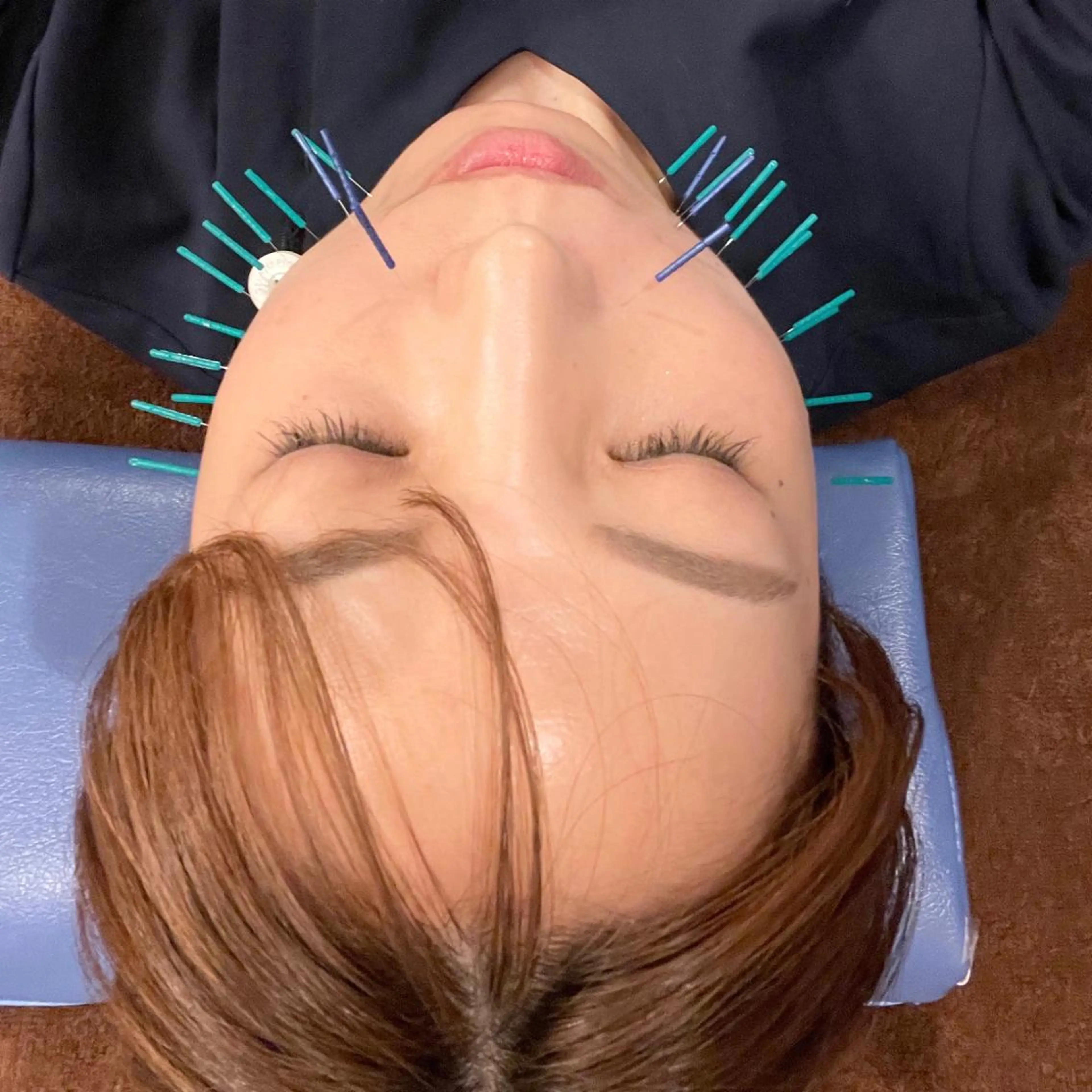 美容鍼　蒼月-aotsuki-所属・美容鍼「蒼月」 -アオツキ-のエステ・リラクイメージ