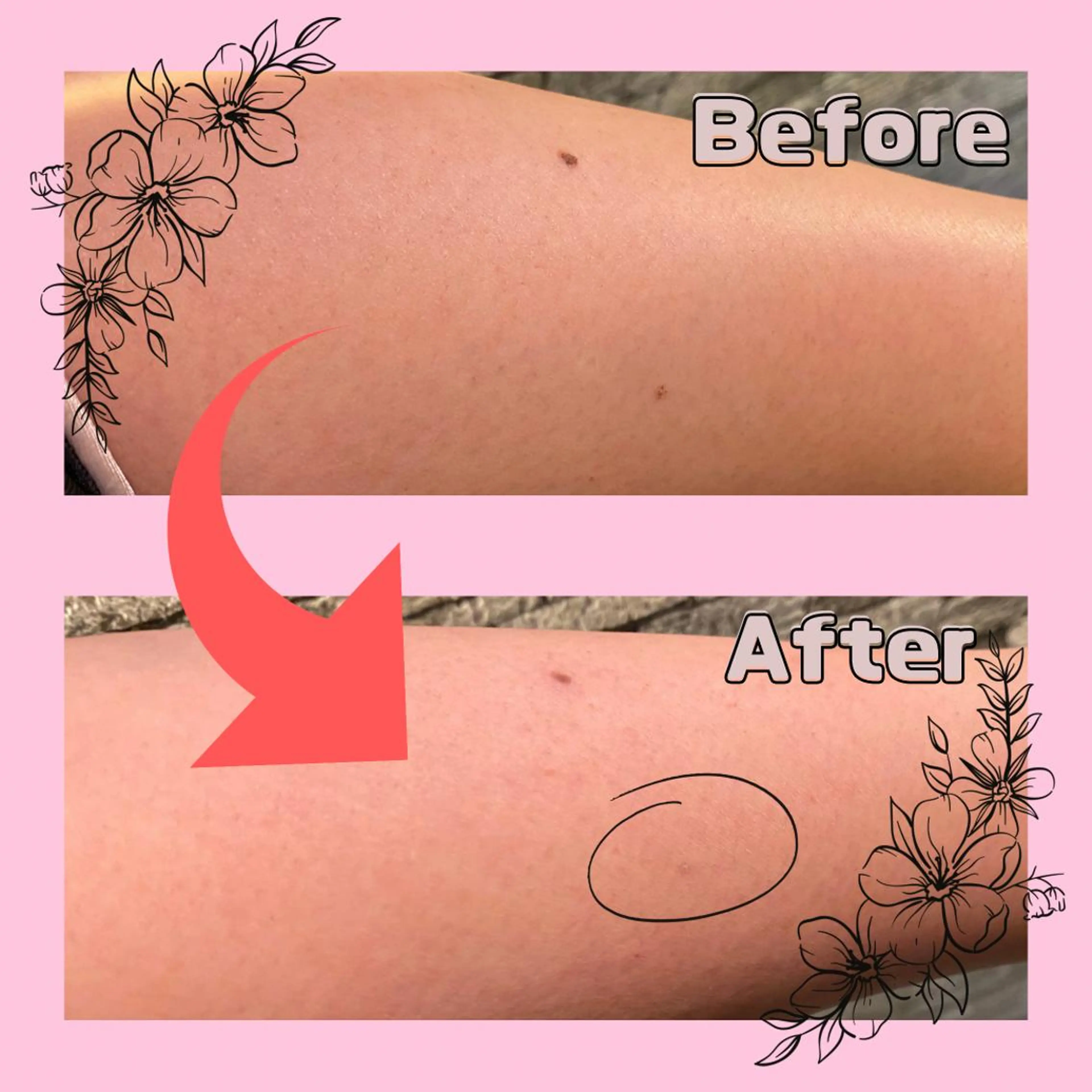 男女同額完全個室脱毛 LEPIA内田のエステ・リラクイメージ