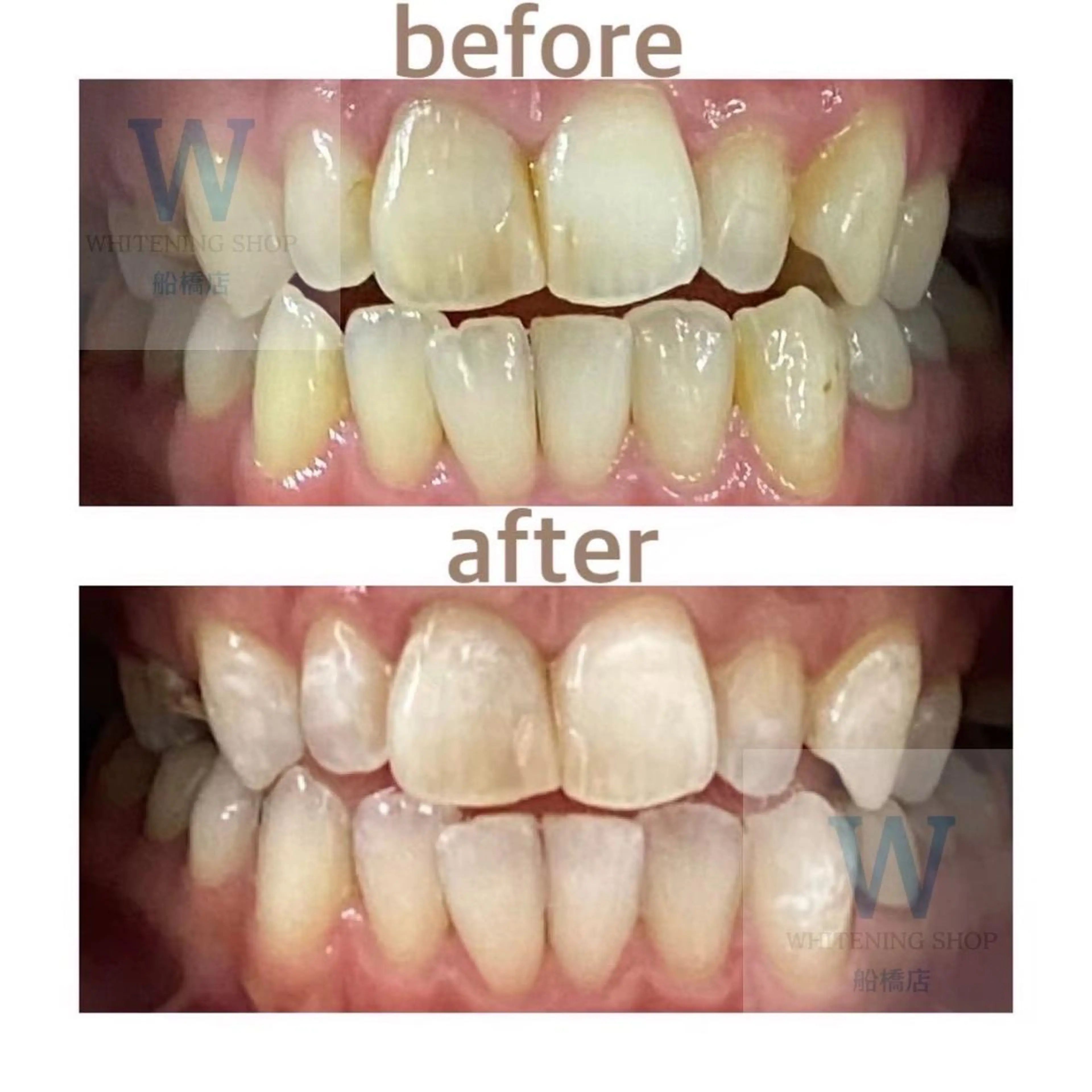 エステ リラク ホワイトニング ショップ船橋店🦷のエステ・リラクイメージ