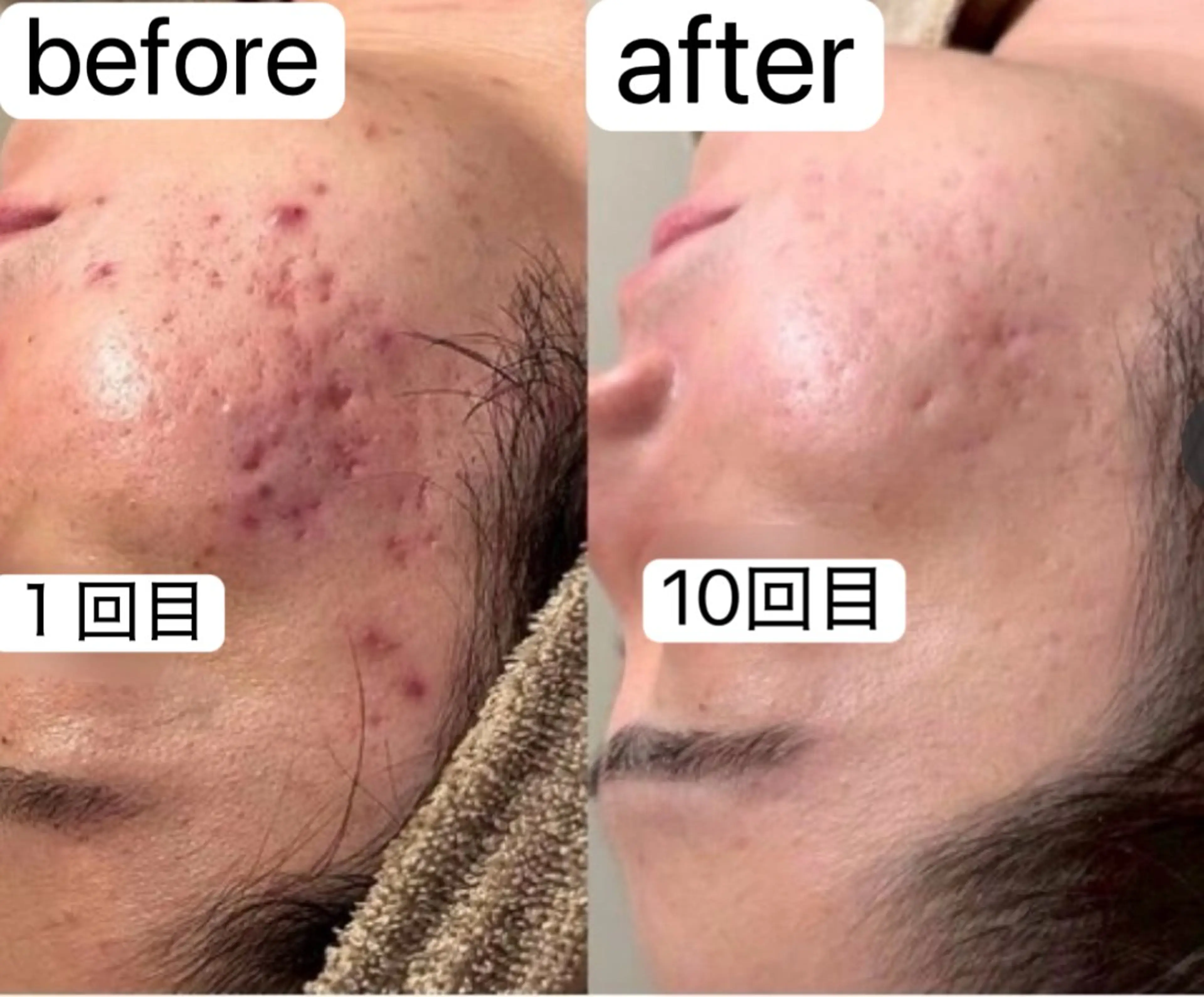 Belle原宿所属・佐藤 加奈のエステ・リラクイメージ