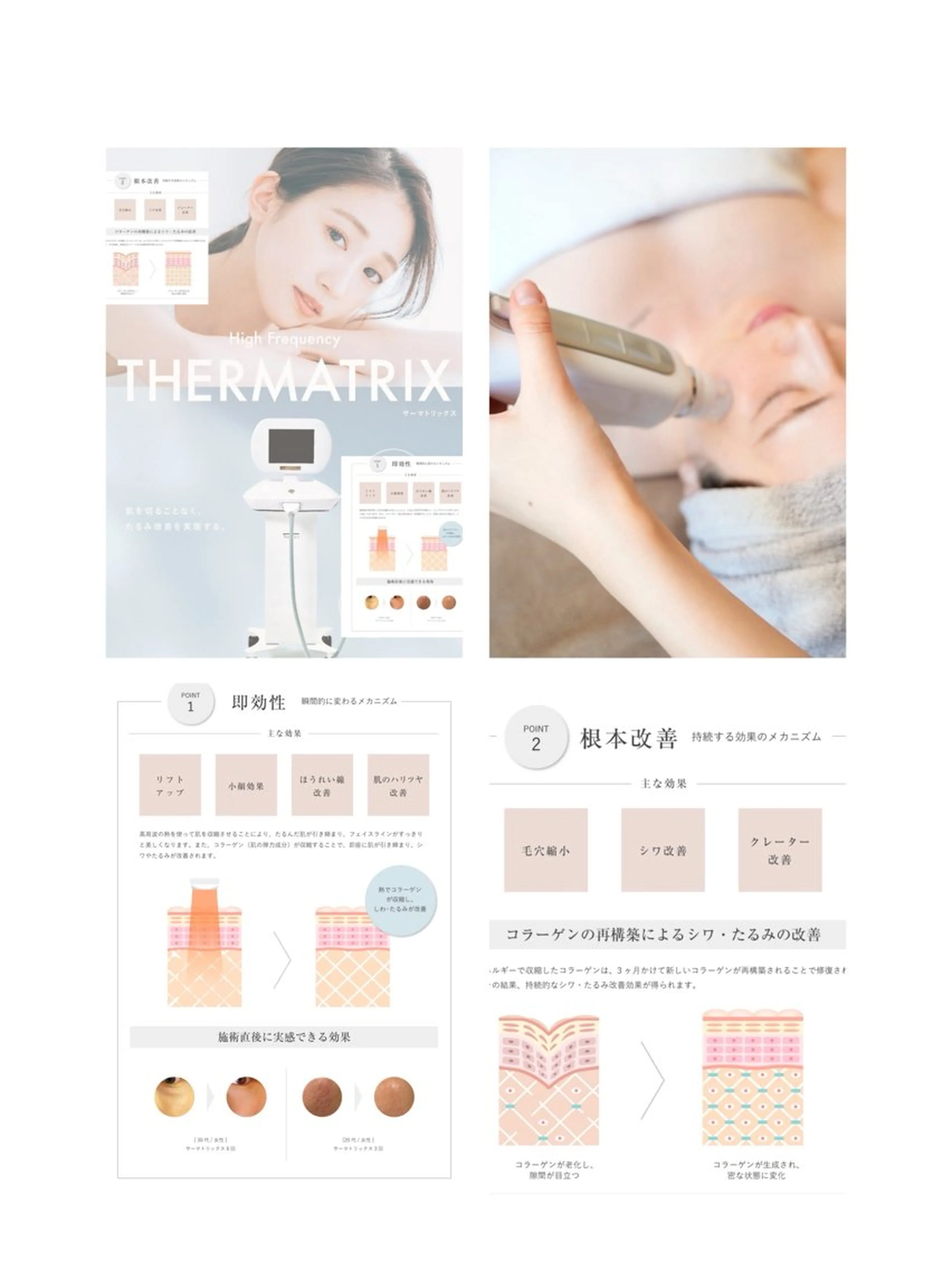 ハリも艶も小顔も❗️【サーマトリックス　フルフェイス➕あご下】究極の引き締めを❣️の写真