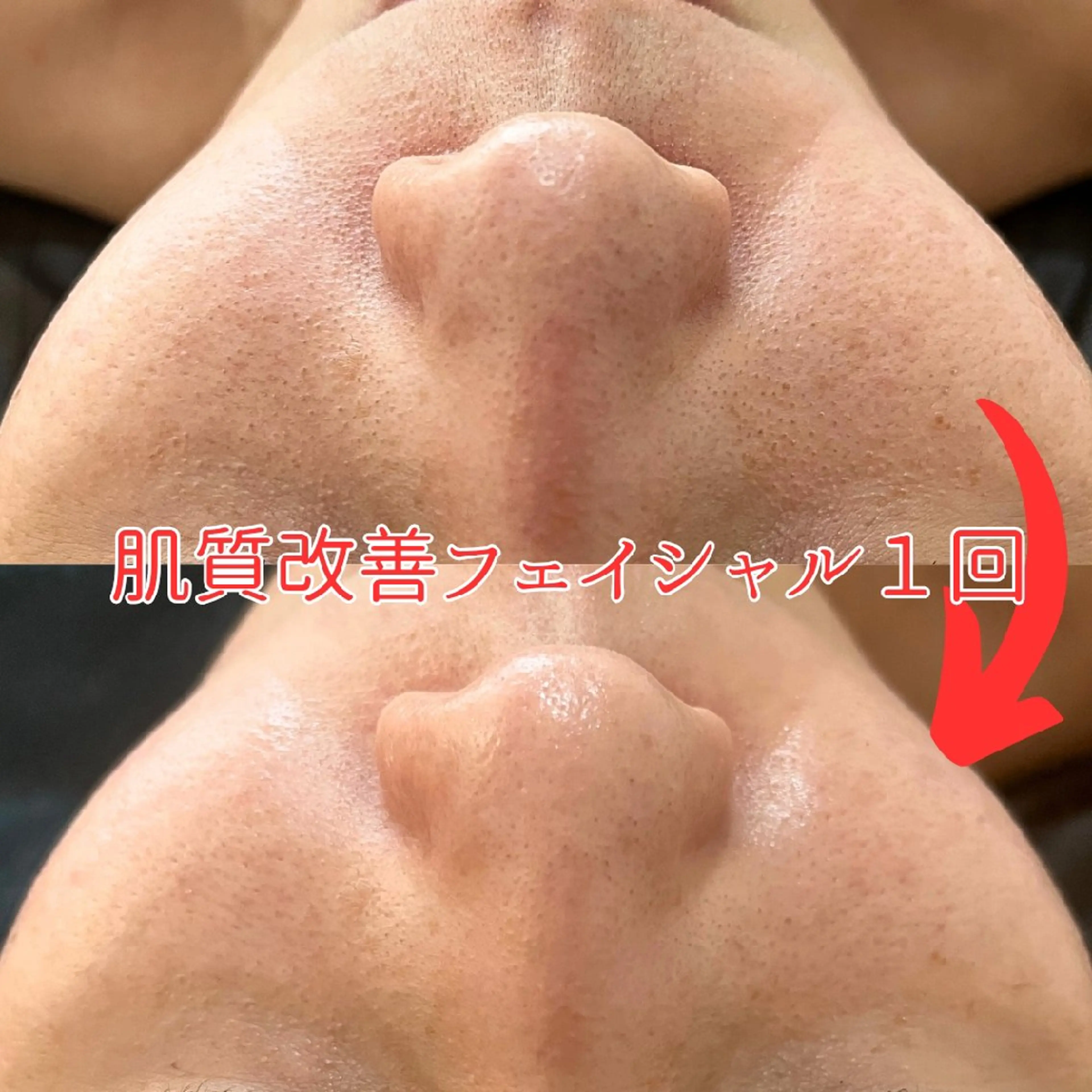 小顔コルギ&肌質改善 の専門店LIBREのエステ・リラクイメージ