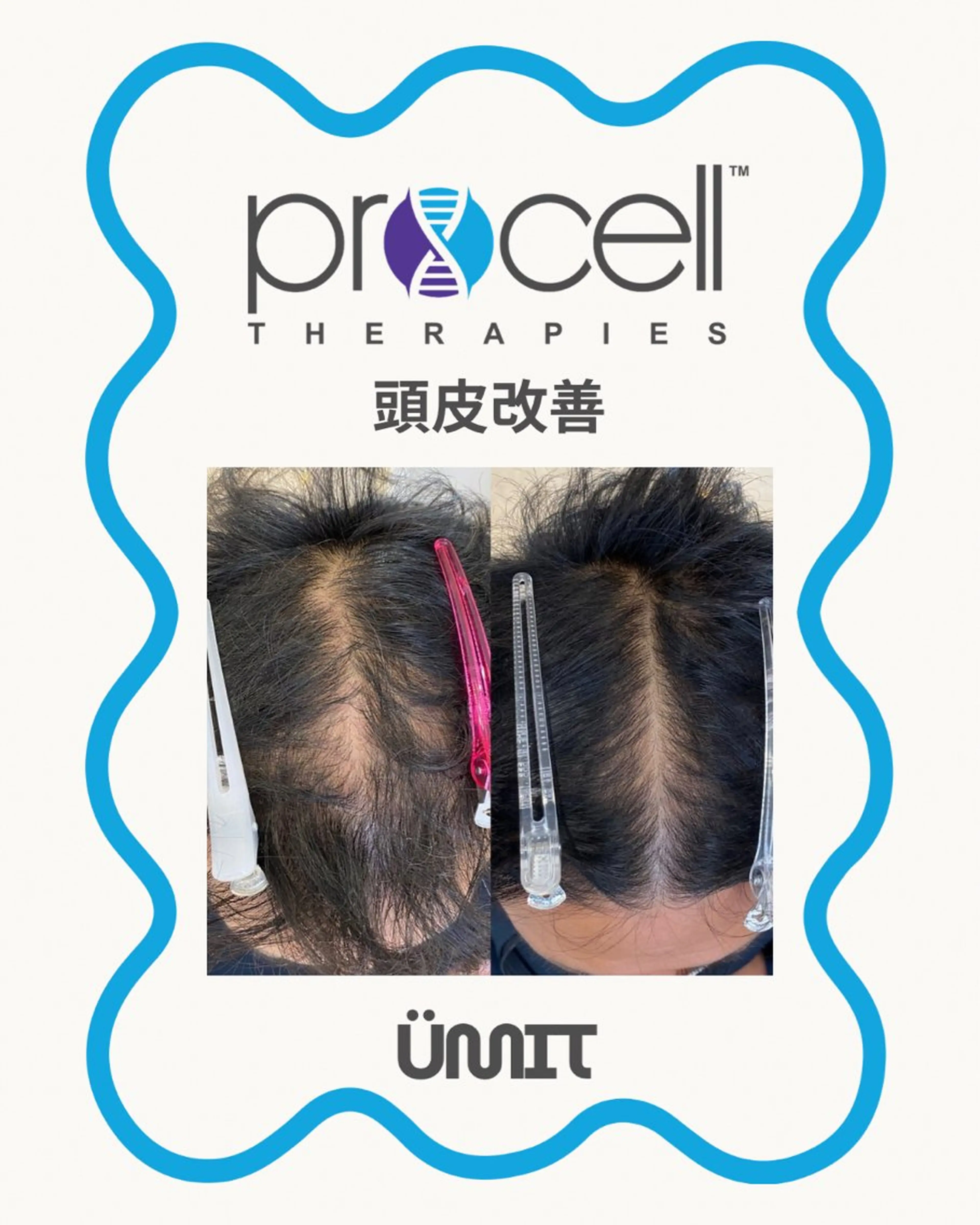 メンズ ヘッドスパ Ümit（ユミト） プロセルセラピーズのヘアスタイル