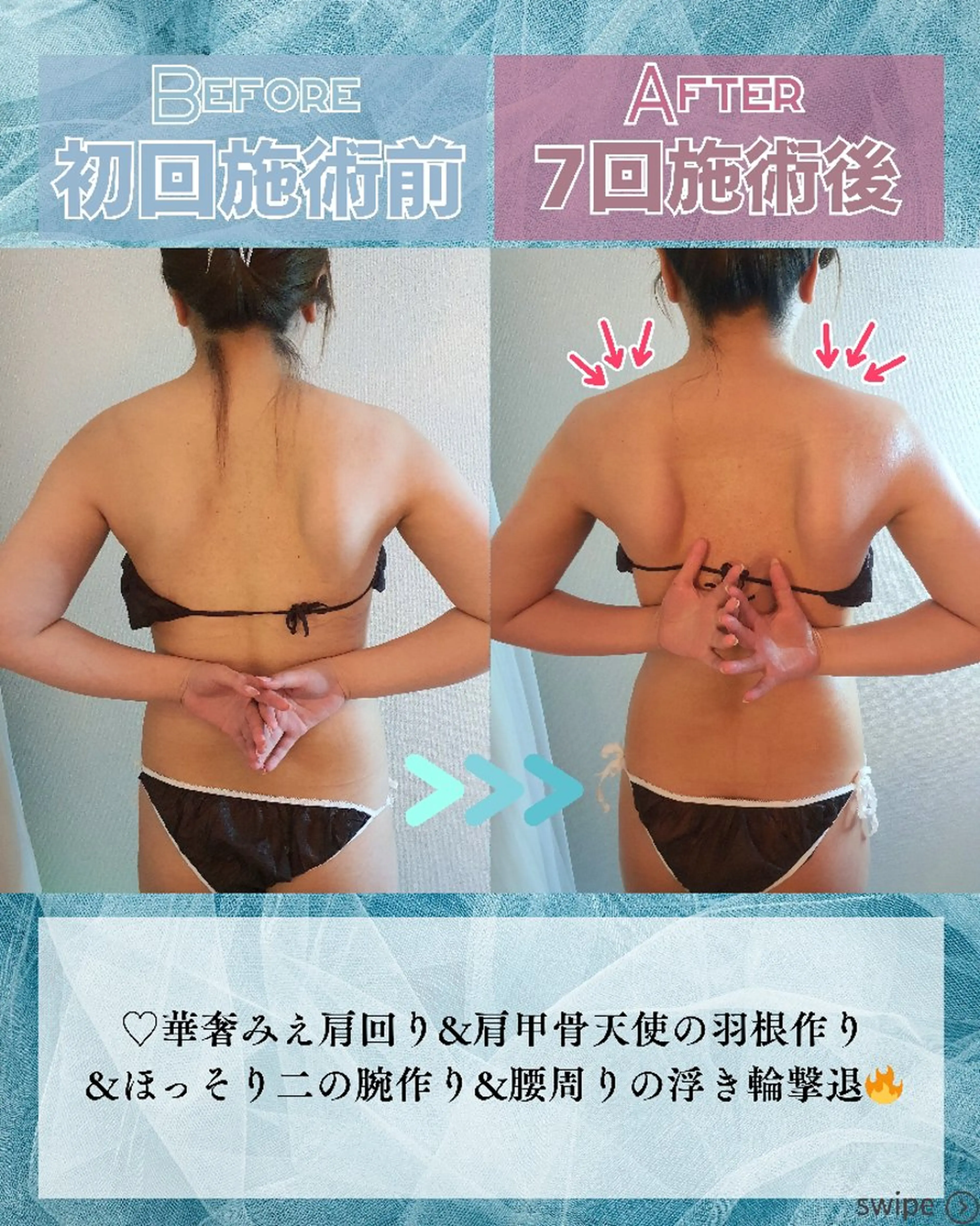 エステ リラク 痩身ハーブピーリング 筋膜リリース☆B&Hのエステ・リラクイメージ