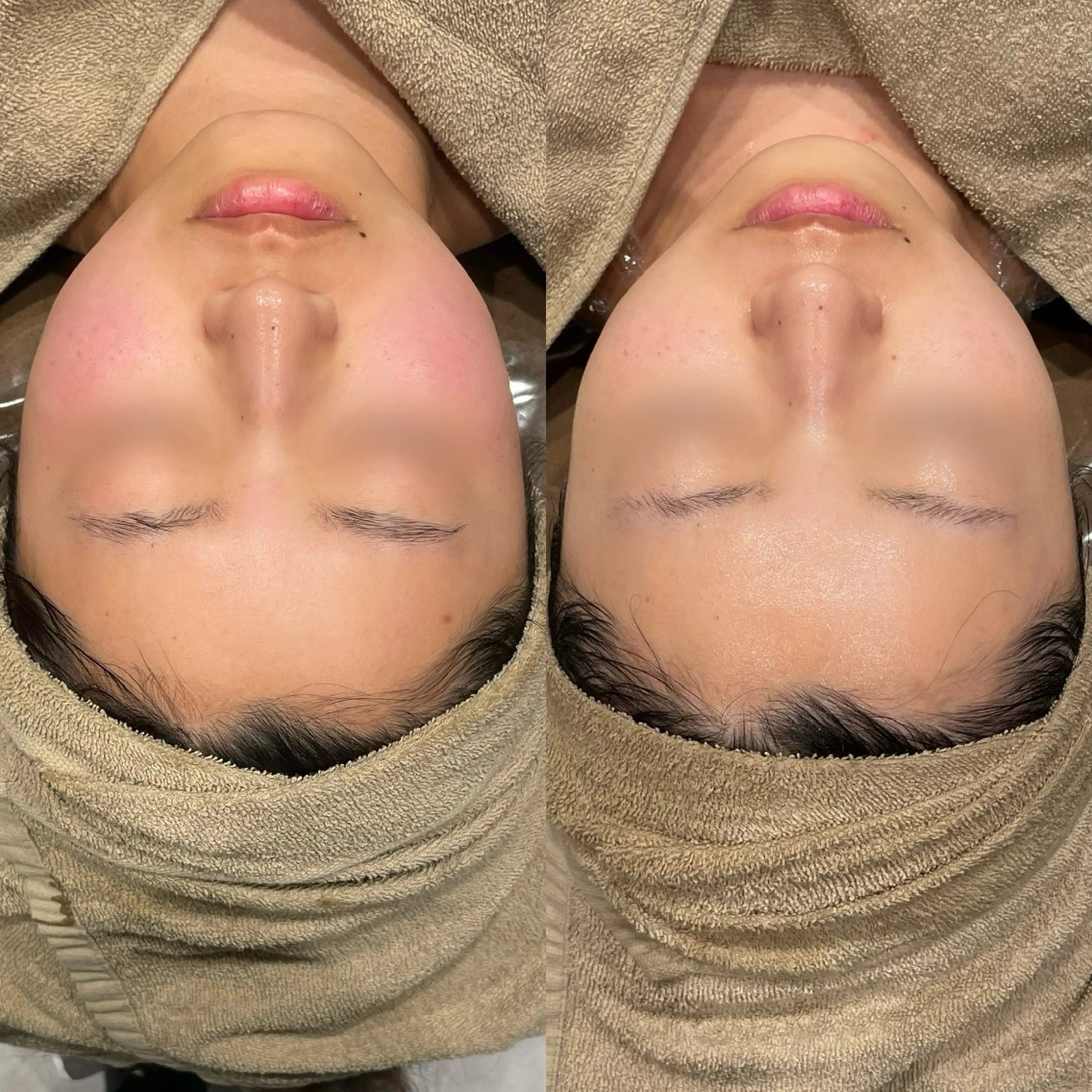 エステ Re:Belle所属・Re:Belle 久留米 : 中島のエステ・リラクイメージ