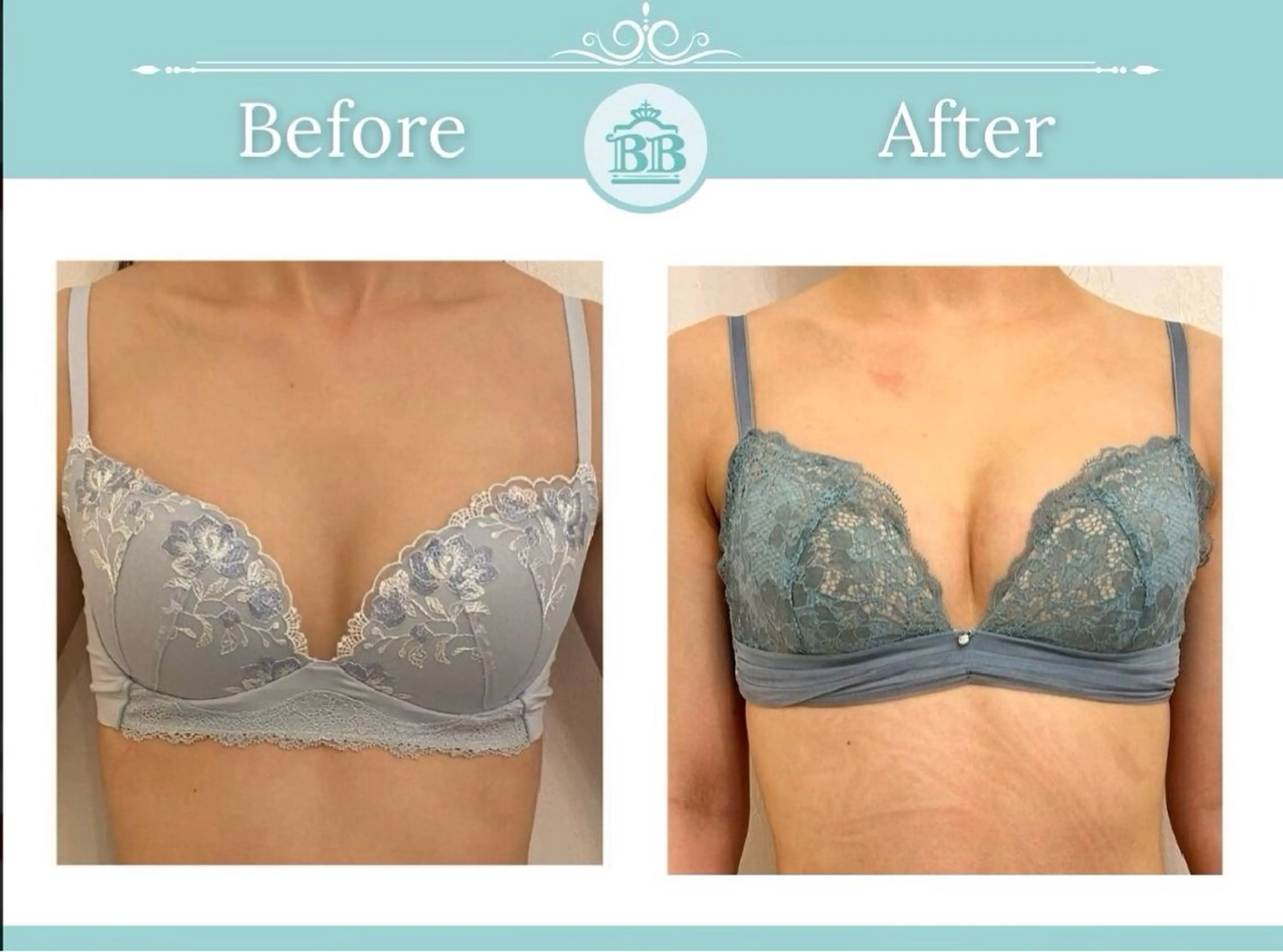 エステ 美人バスト本厚木店所属・美人バスト 本厚木店のエステ・リラクイメージ