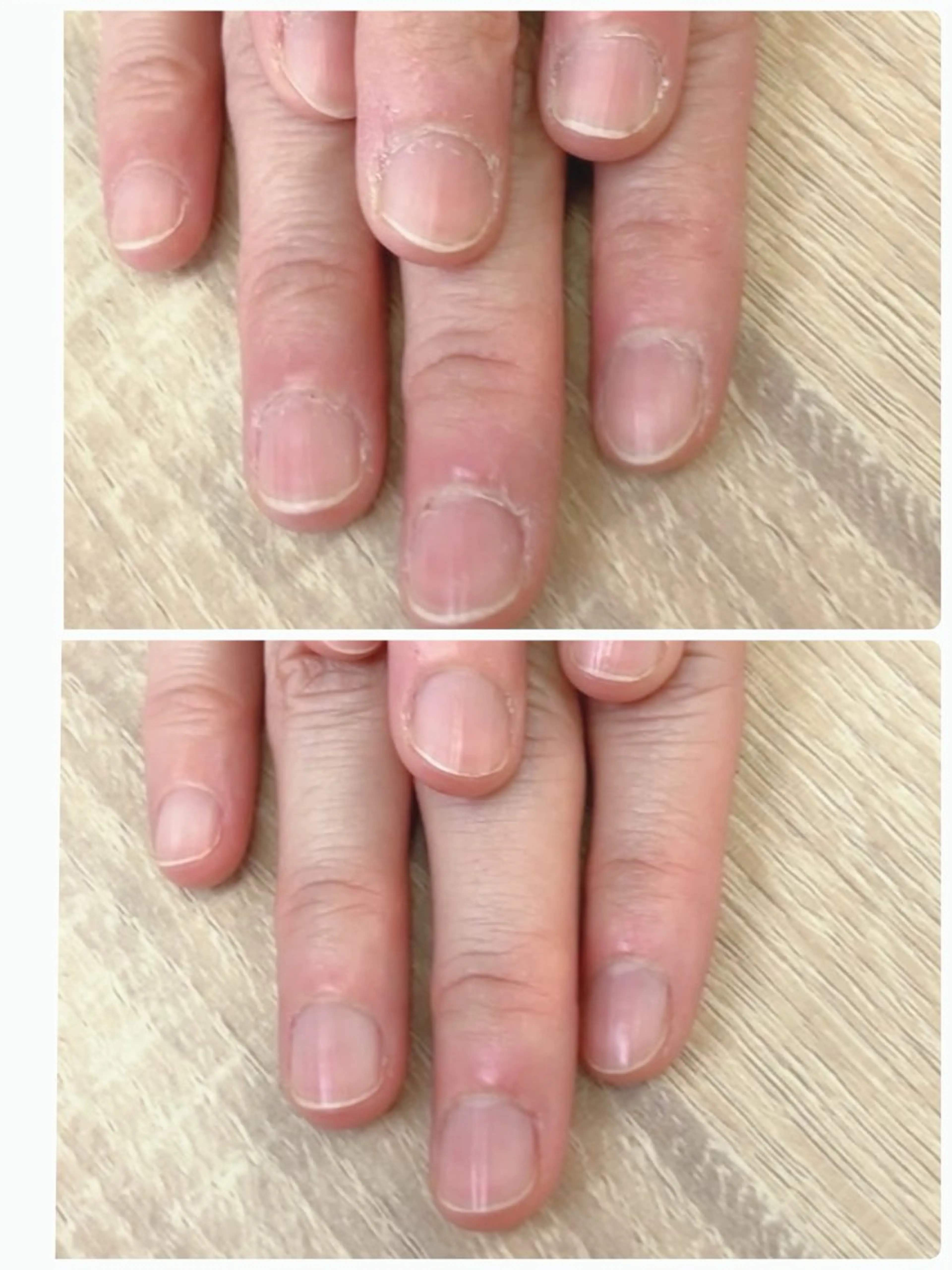 自爪つやアップ★ファイリング＋甘皮＋ささくれケアの写真