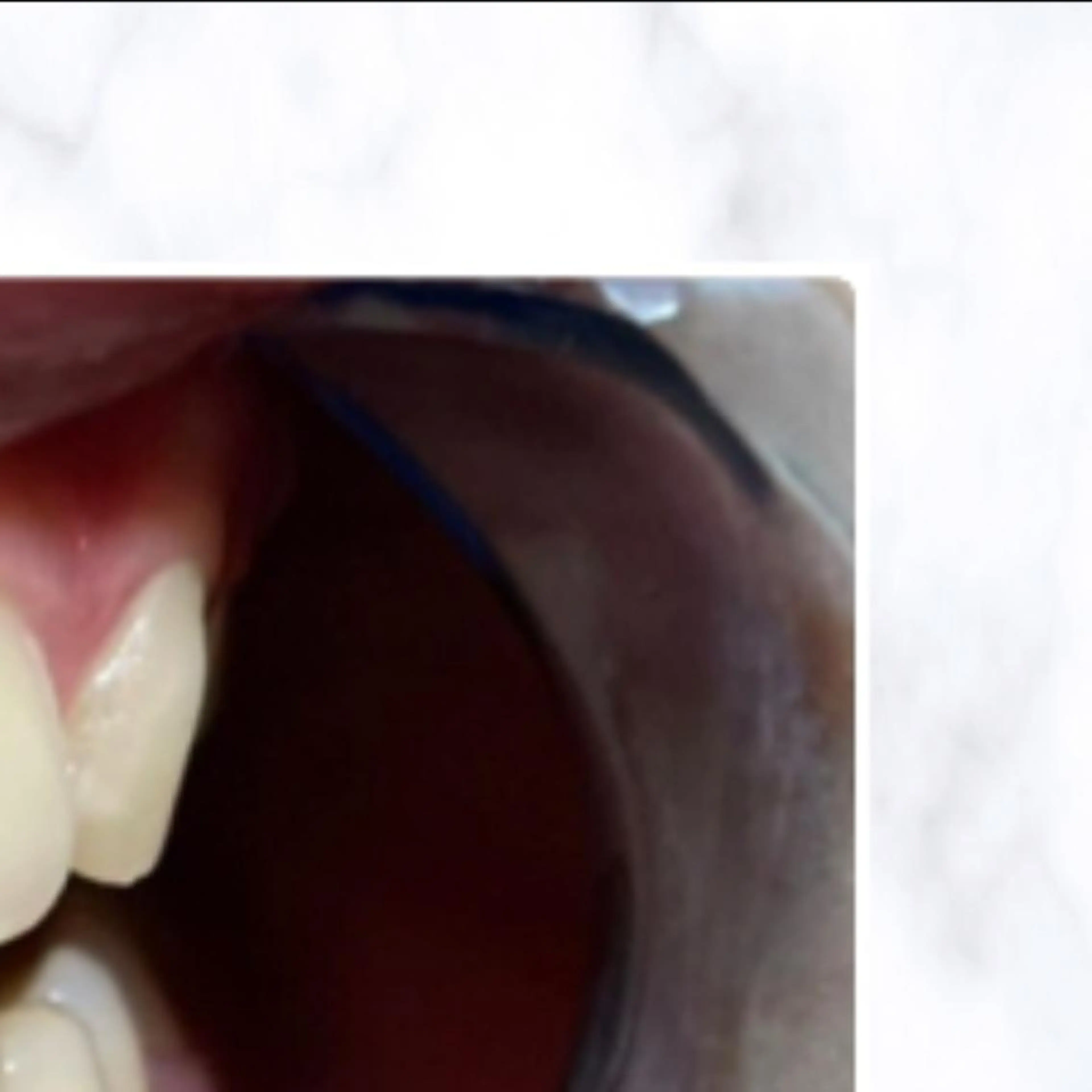 その他 ライトケアサロン 渋谷店② 渡邊のその他イメージ