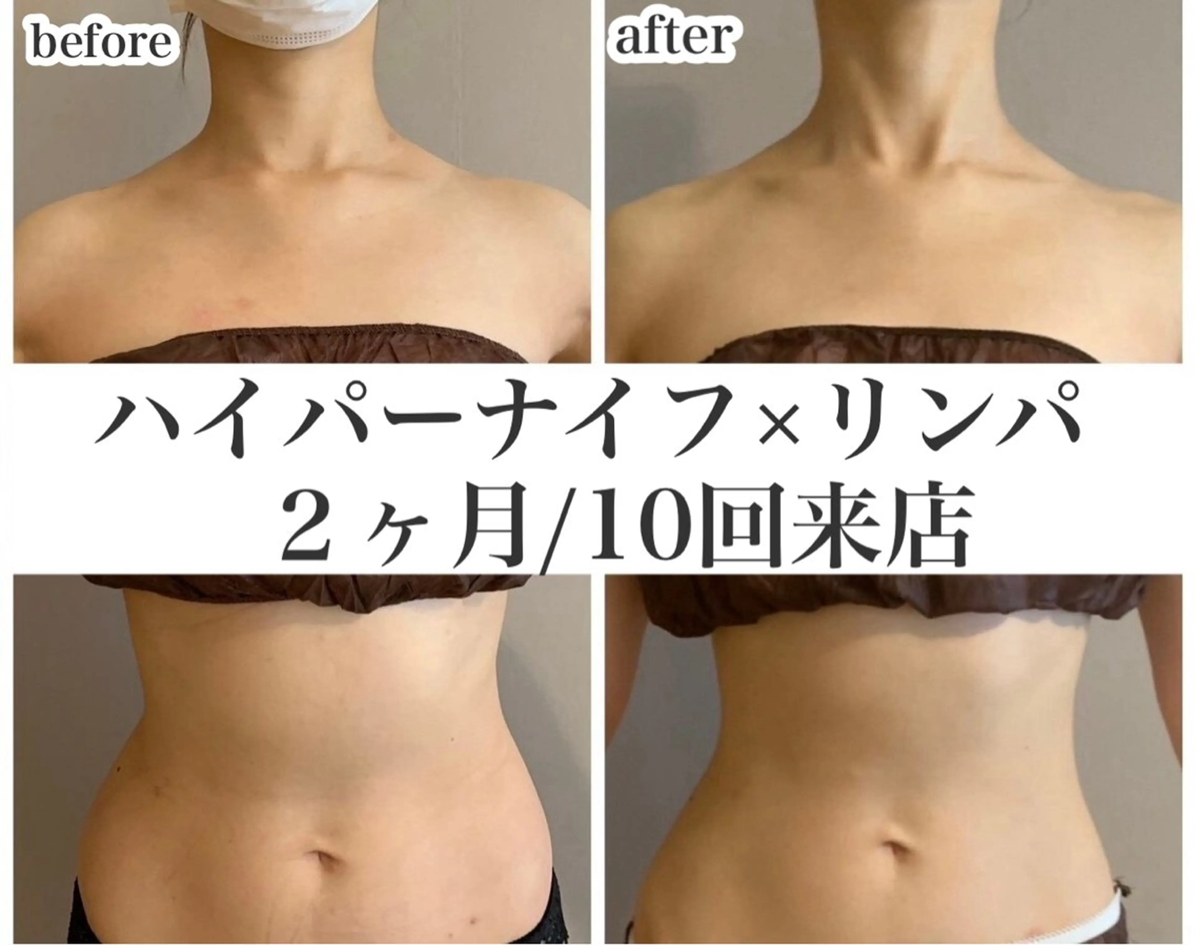 REME/リミー エステサロン東大宮店所属・小林 雪乃のエステ・リラクイメージ