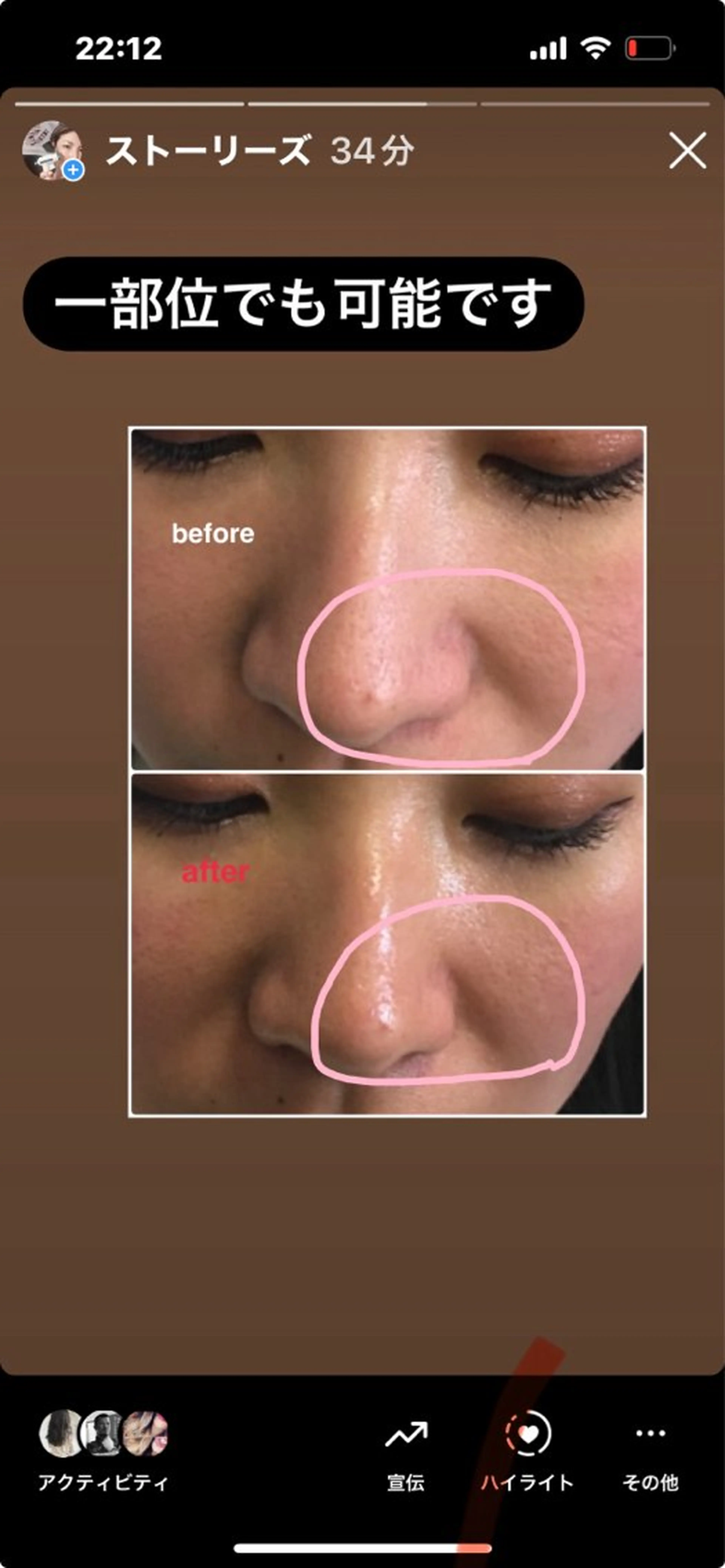 毛穴小顔・痩身サロン メイク・ド・ミュウのその他イメージ