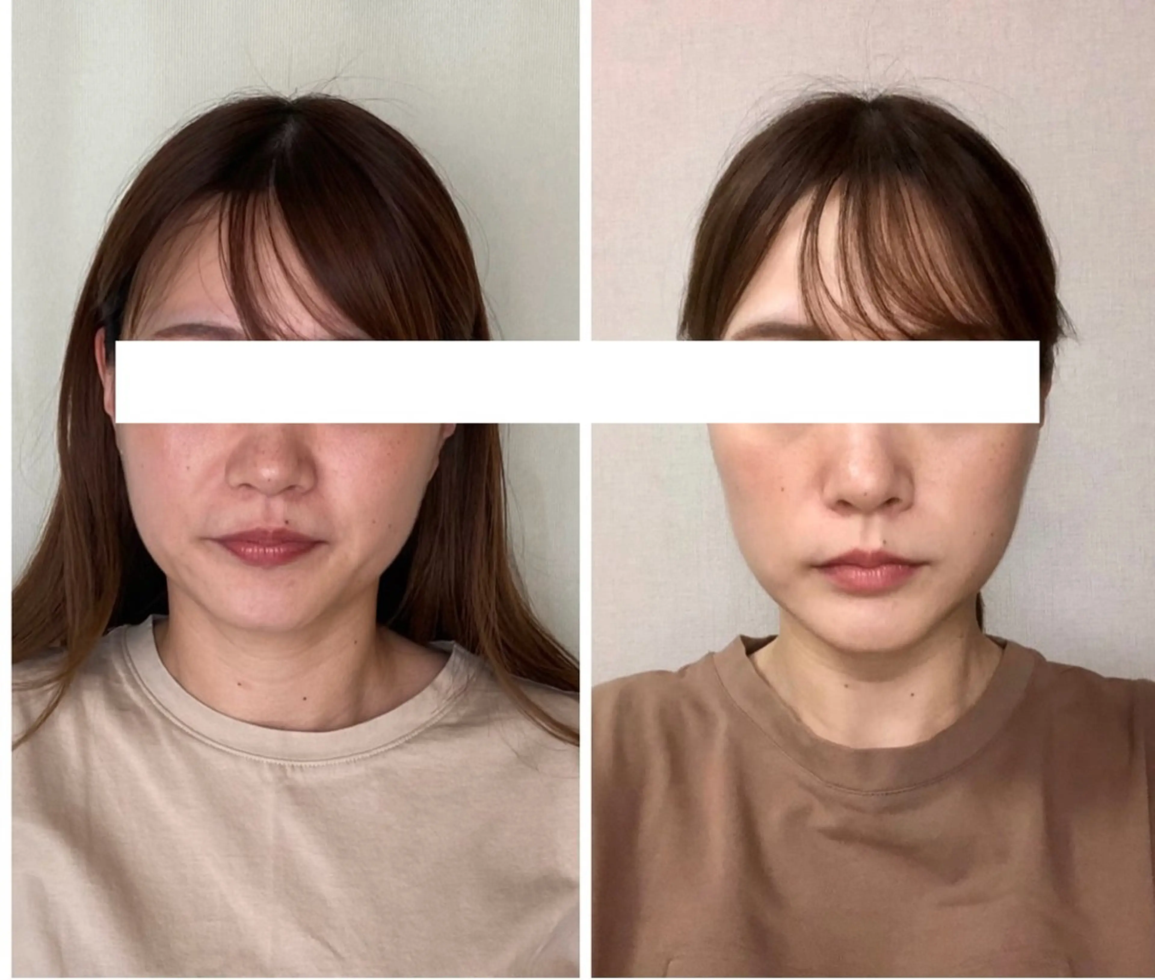 小顔効果抜群！【エンドリングフェイシャル®︎ 】スタンダードコースの写真