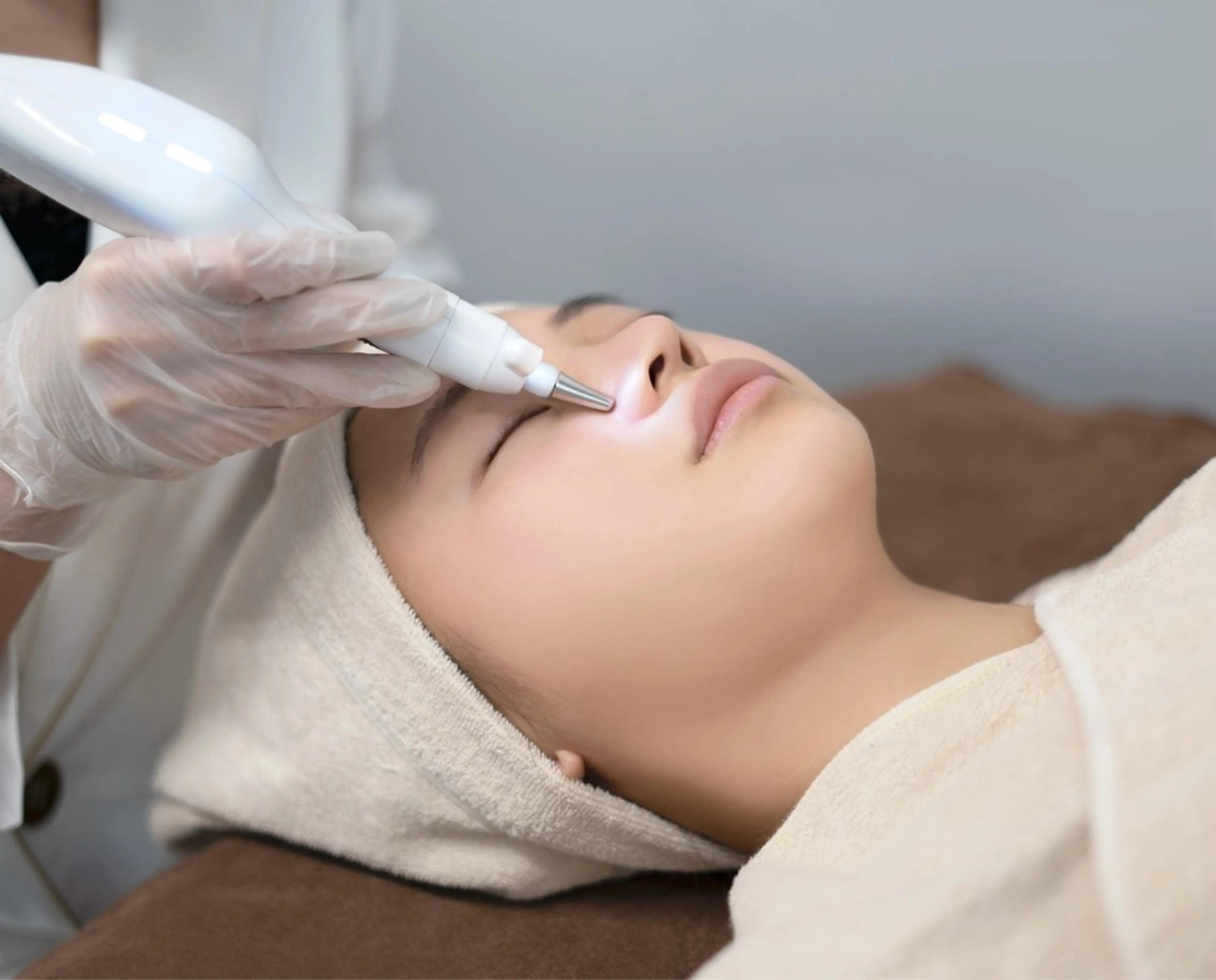 プラズマスポット（10個まで、）の写真