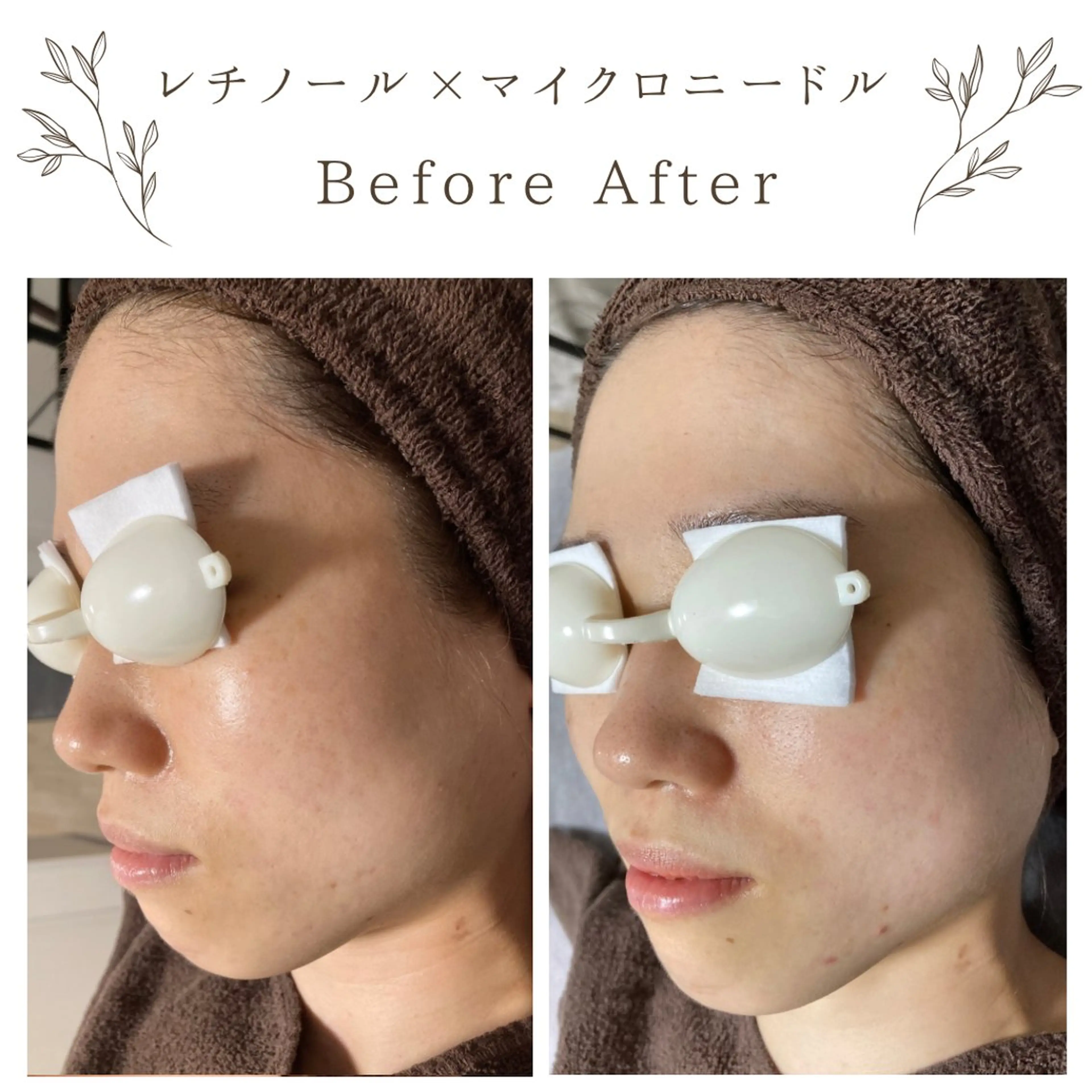 な ぎのエステ・リラクイメージ