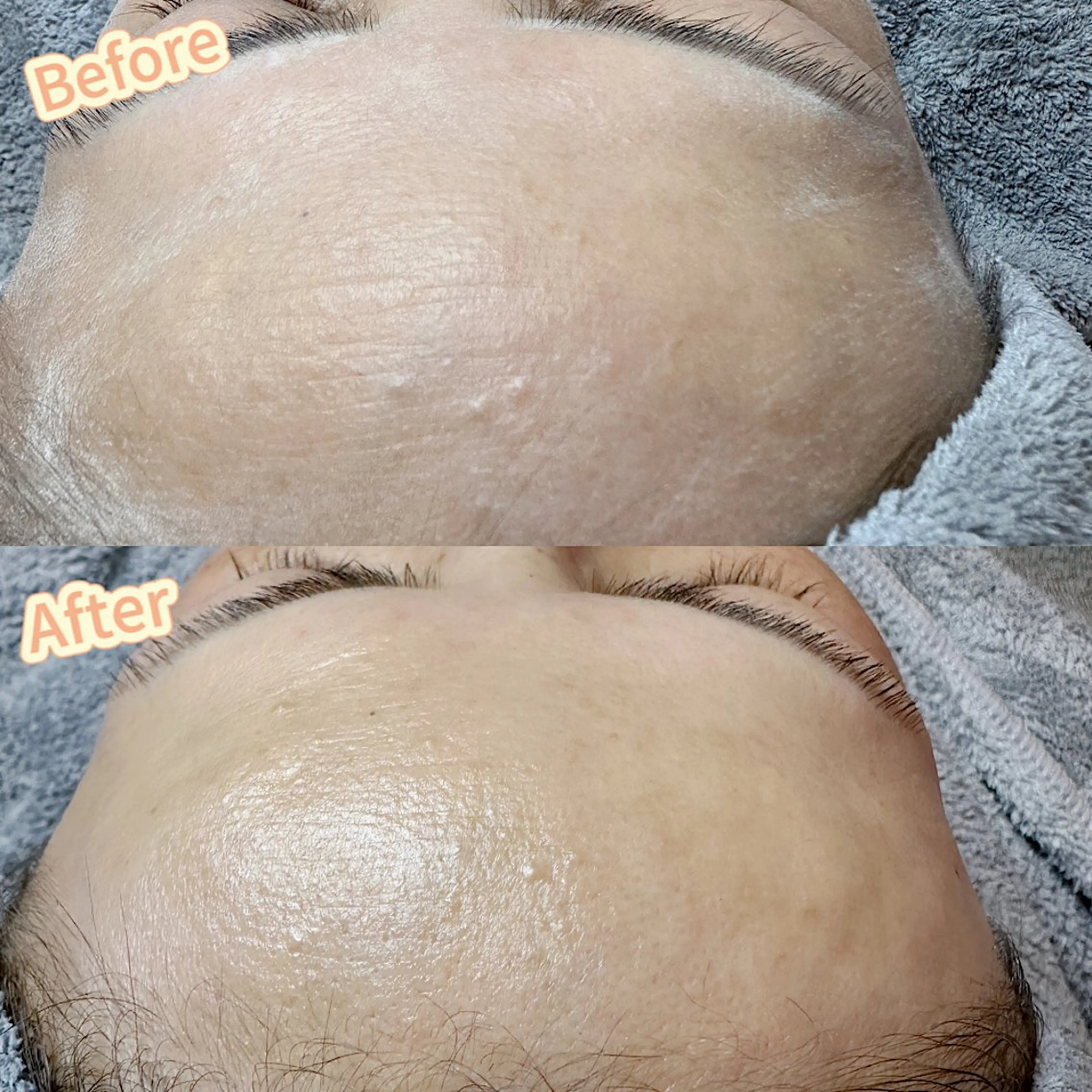 Hit. シュガーリング豊橋のエステ・リラクイメージ