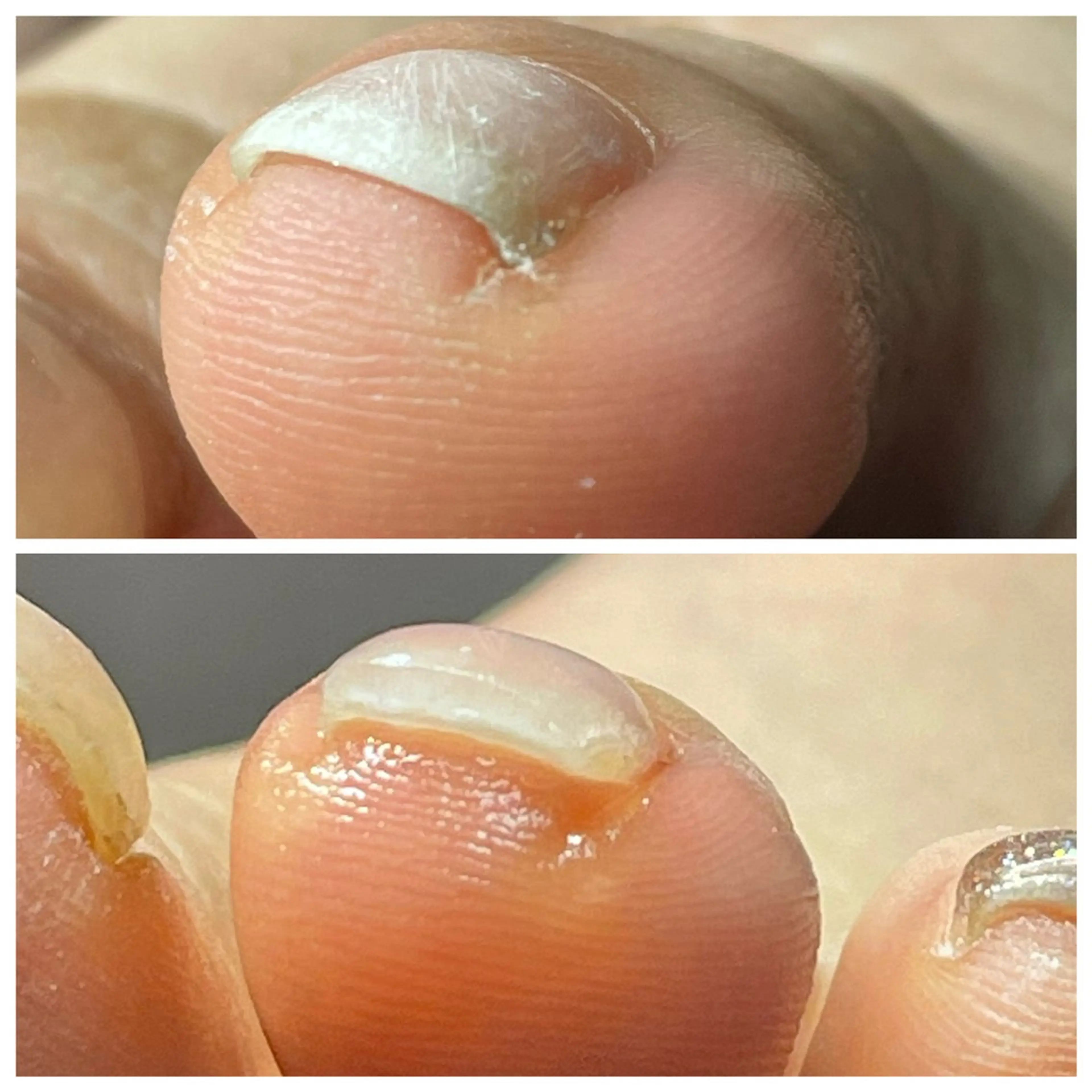 ネイル その他 Wind.ウィンドネ イルケア耳つぼ専門店のその他イメージ