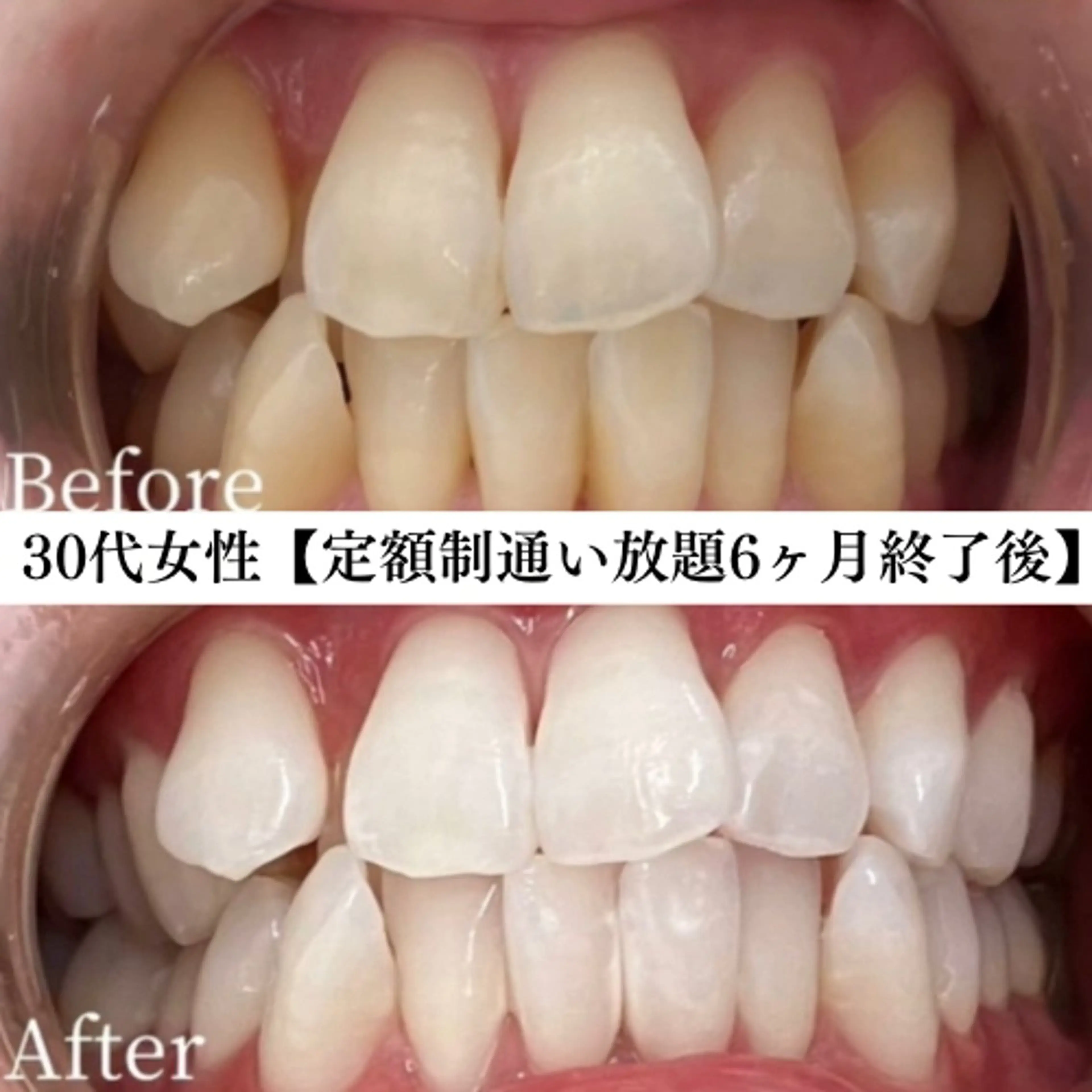 キッズ メンズ エステ リラク セルフホワイトニング専門店WHITE福岡天神店所属・セルフホワイト専門店 WHITE福岡天神店のエステ・リラクイメージ