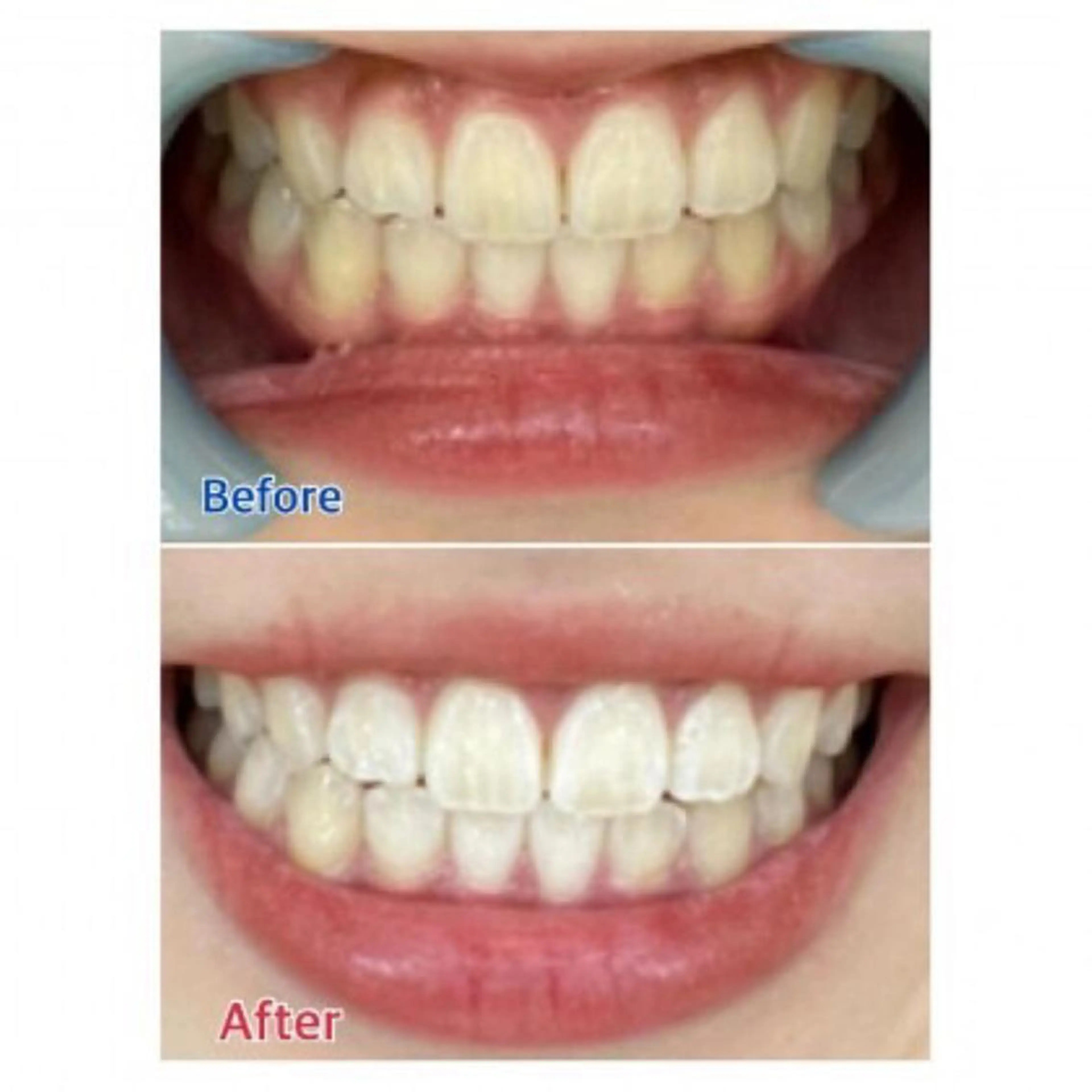 M渋谷店所属・Ｍ渋谷 ホワイトニングのエステ・リラクイメージ