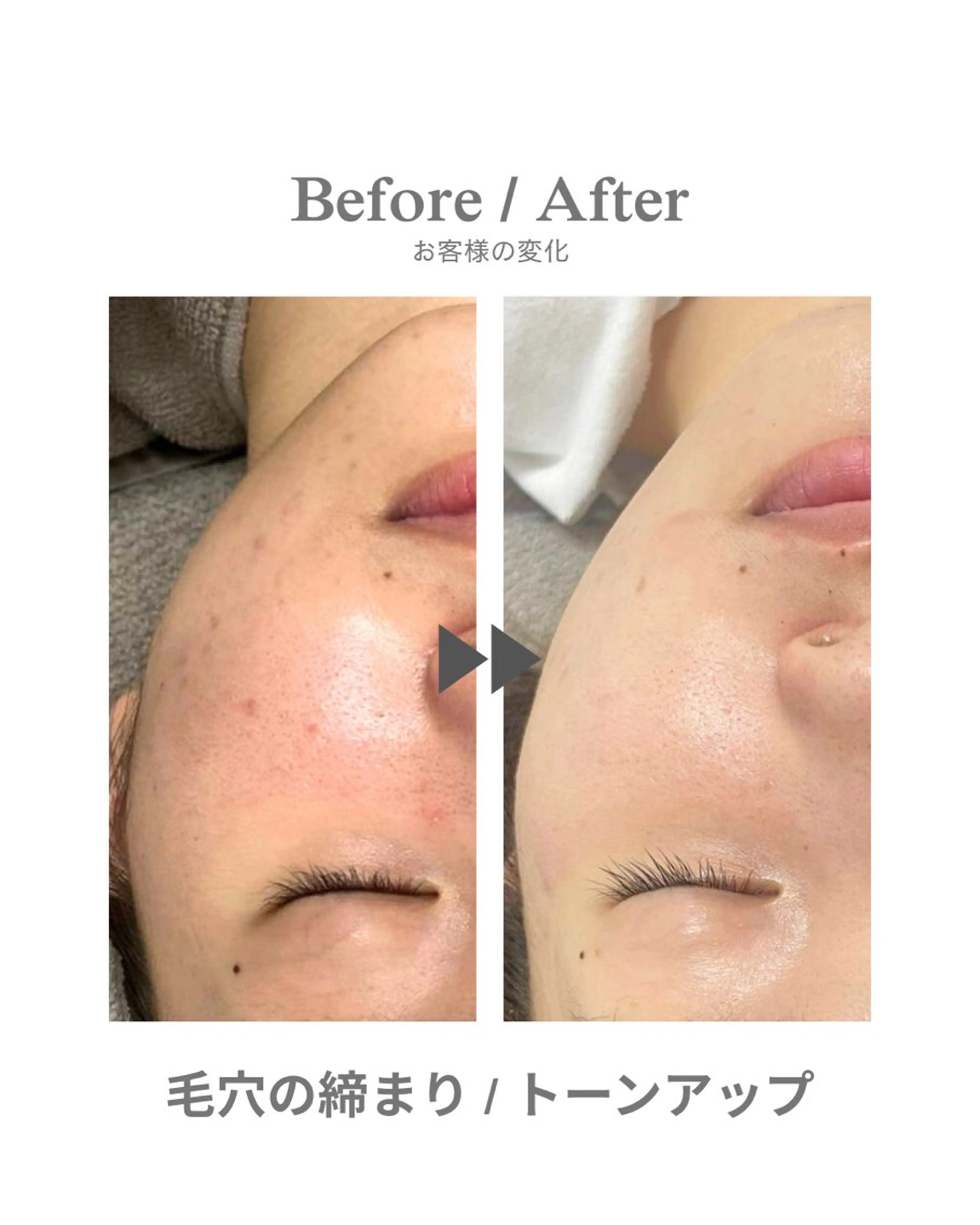 エステ エステサロンNarcis〜ナルシス〜所属・脱毛＆痩身エステ Narcisのエステ・リラクイメージ