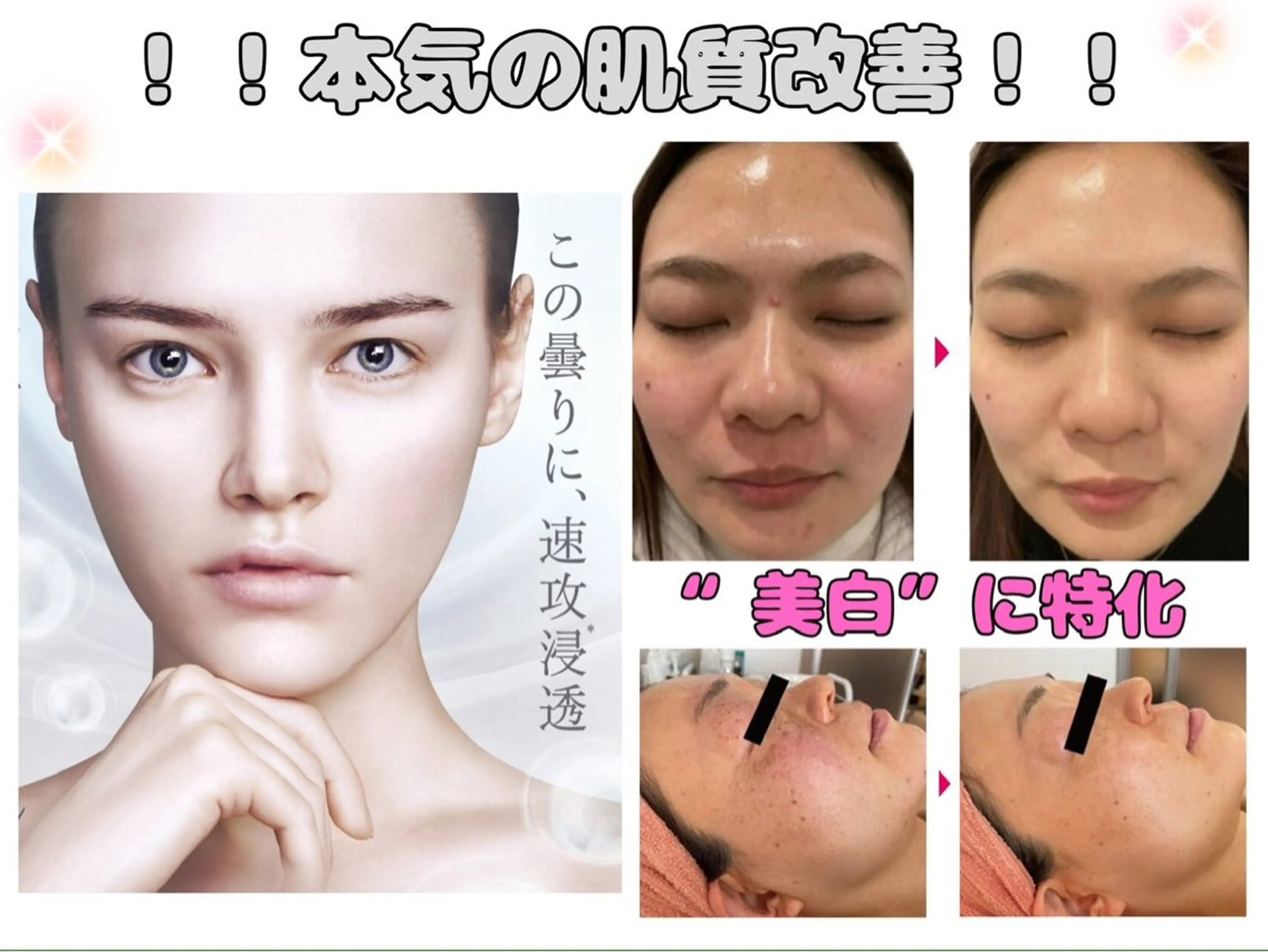 〈毛穴・シミ・くすみケアに〉韓国肌🩷白玉乳酸ピーリングの写真