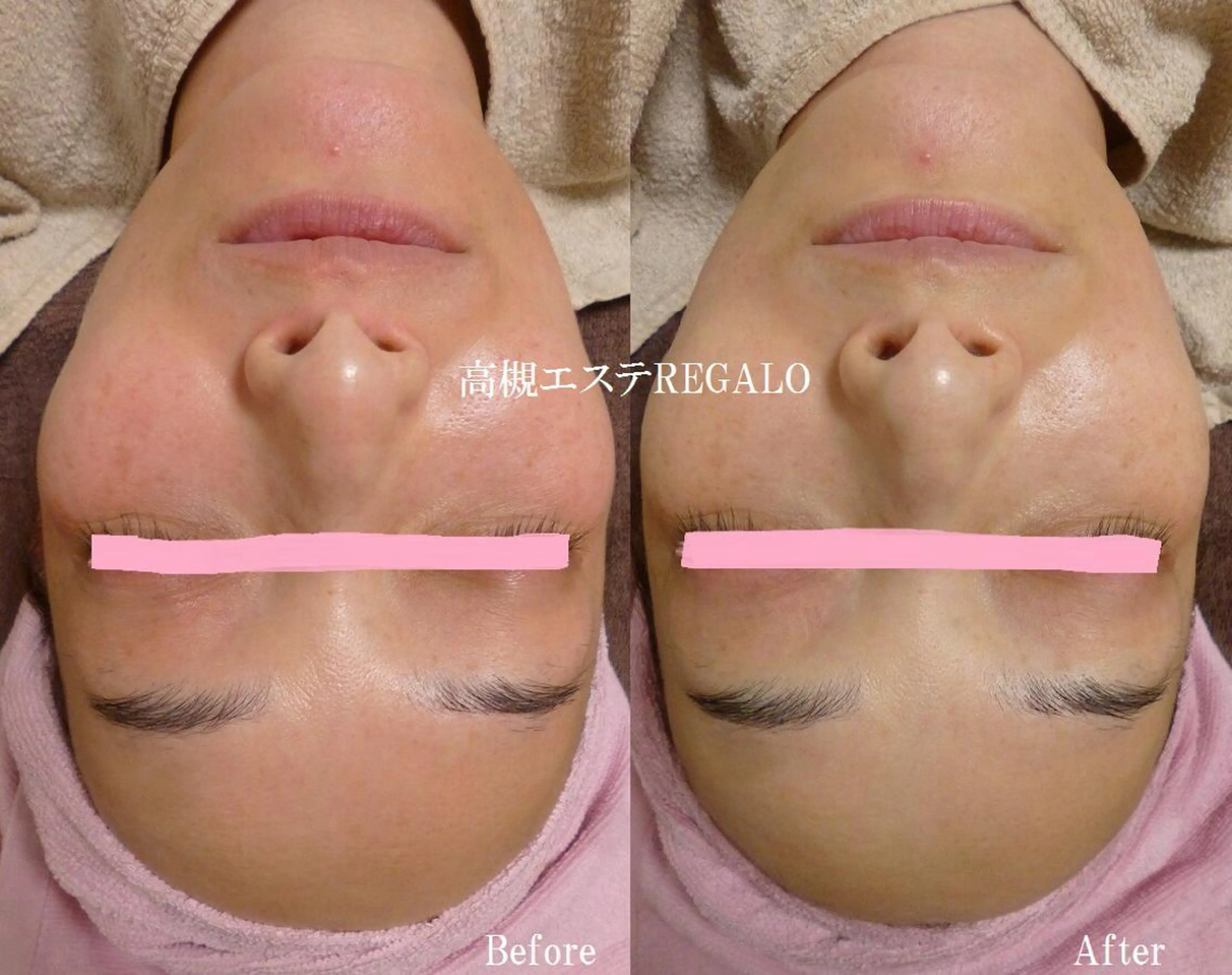 エステ REGALO所属・矢野 さやかのエステ・リラクイメージ