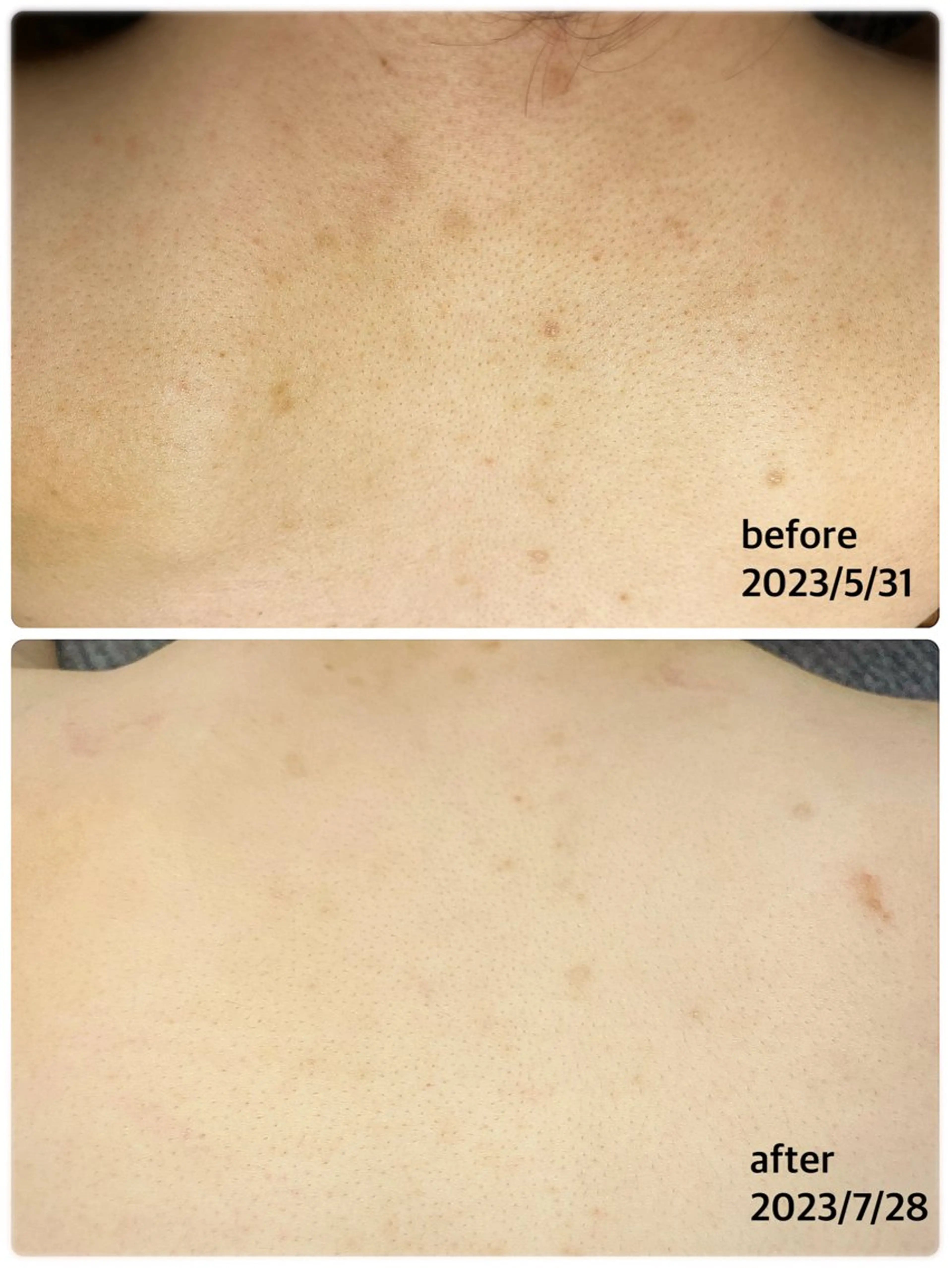 【痩身・脱毛サロン】 REBISKIN🌱のエステ・リラクイメージ