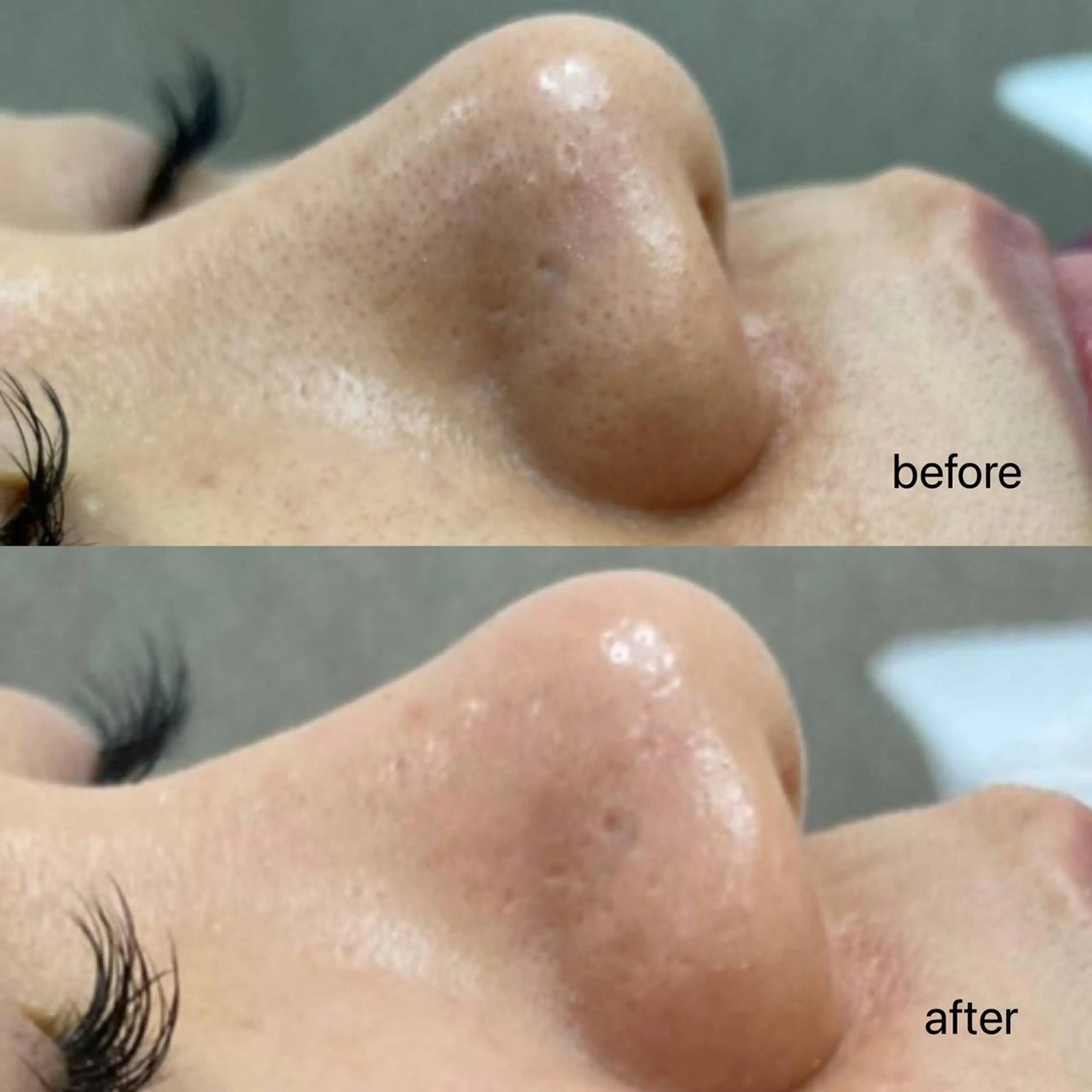 Anacia Beauty Salon所属・美肌脱毛&毛穴専門 Anaciaのエステ・リラクイメージ