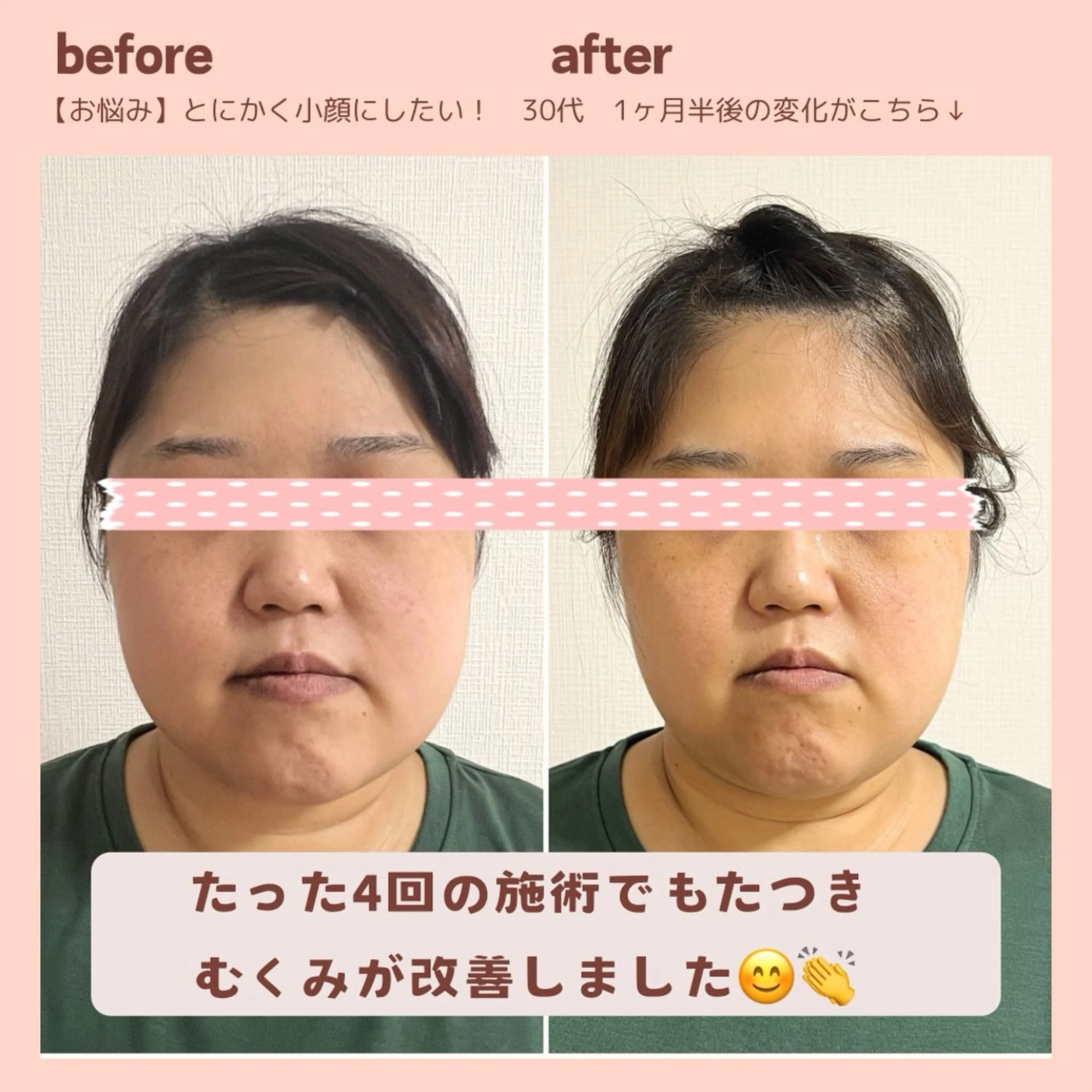 小顔矯正& 慢性肩こり腰痛改善店のエステ・リラクイメージ