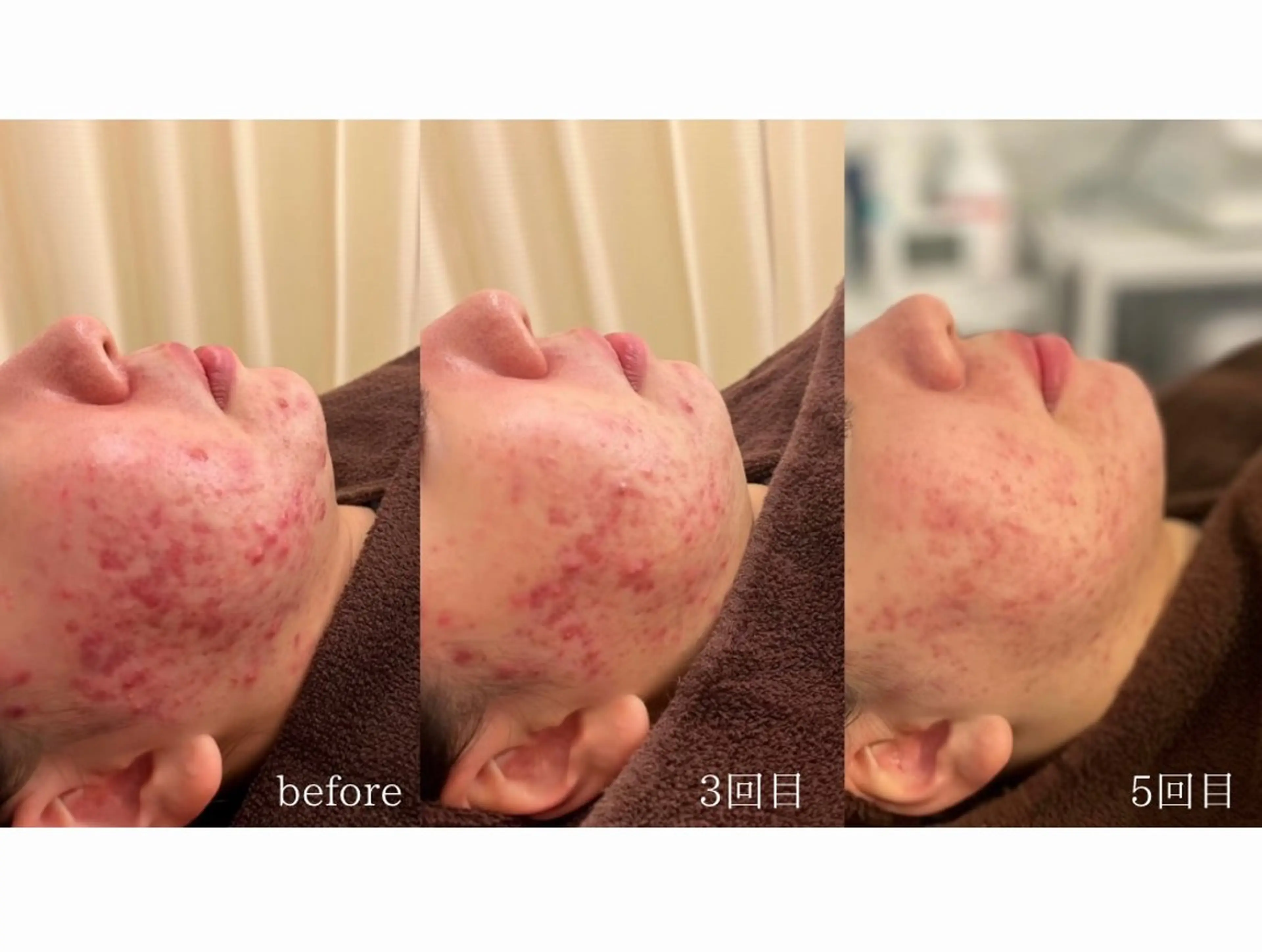 エステ 美肌ケアサロン iru【アイル】のエステ・リラクイメージ