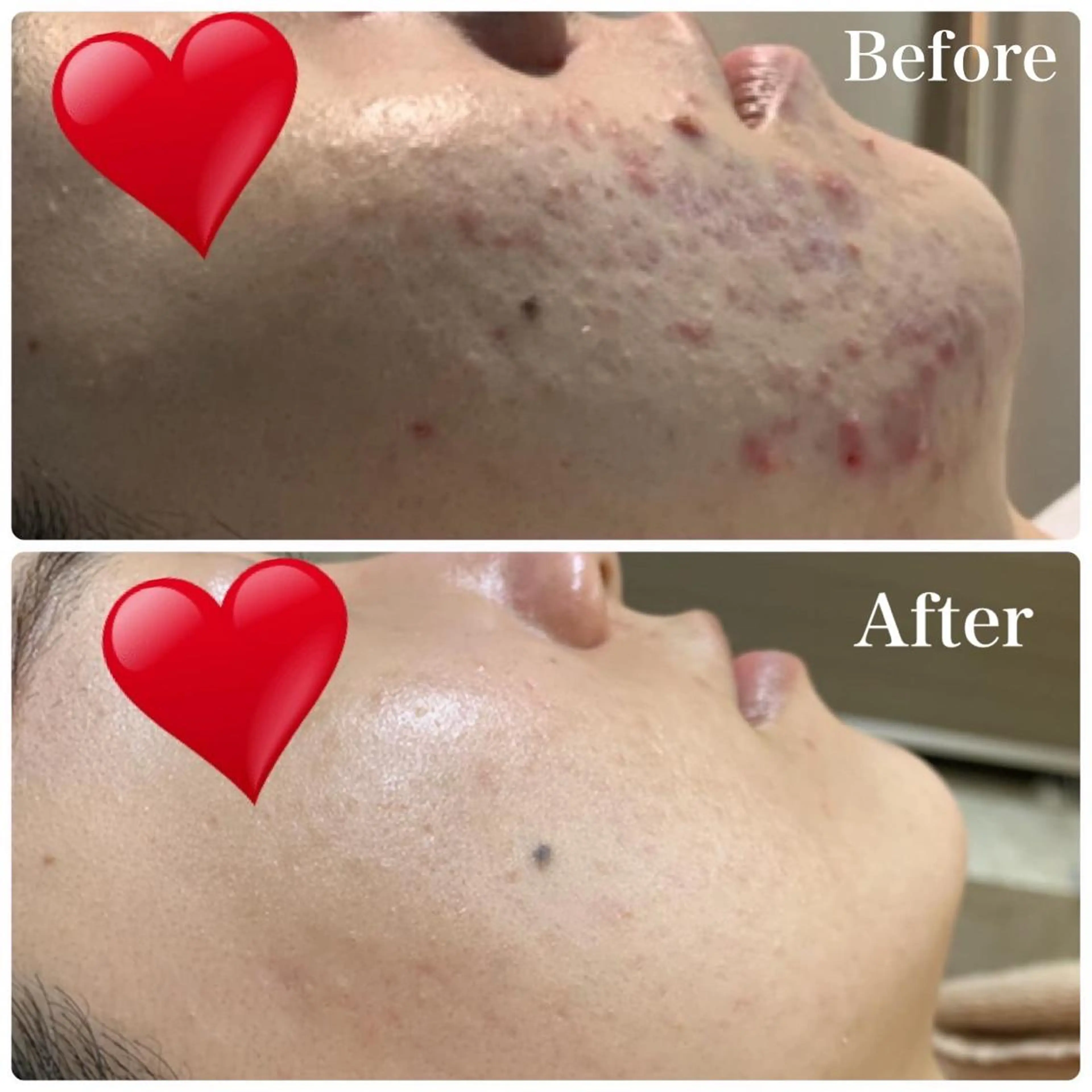 エステ 産後/ツヤ肌/子連れ /保育士在籍サロンのエステ・リラクイメージ