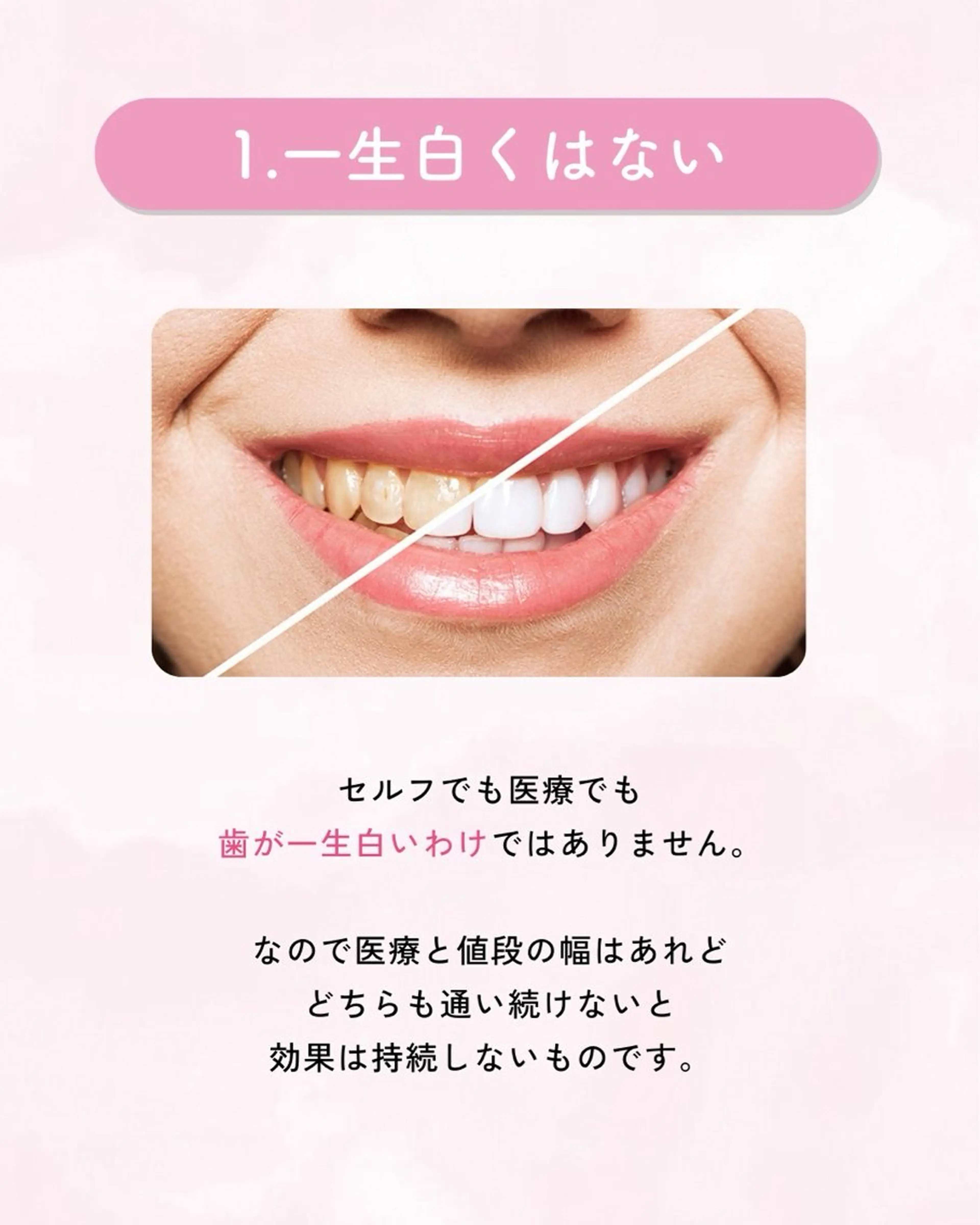 セルフホワイトニング エクシア大曽根店のその他イメージ