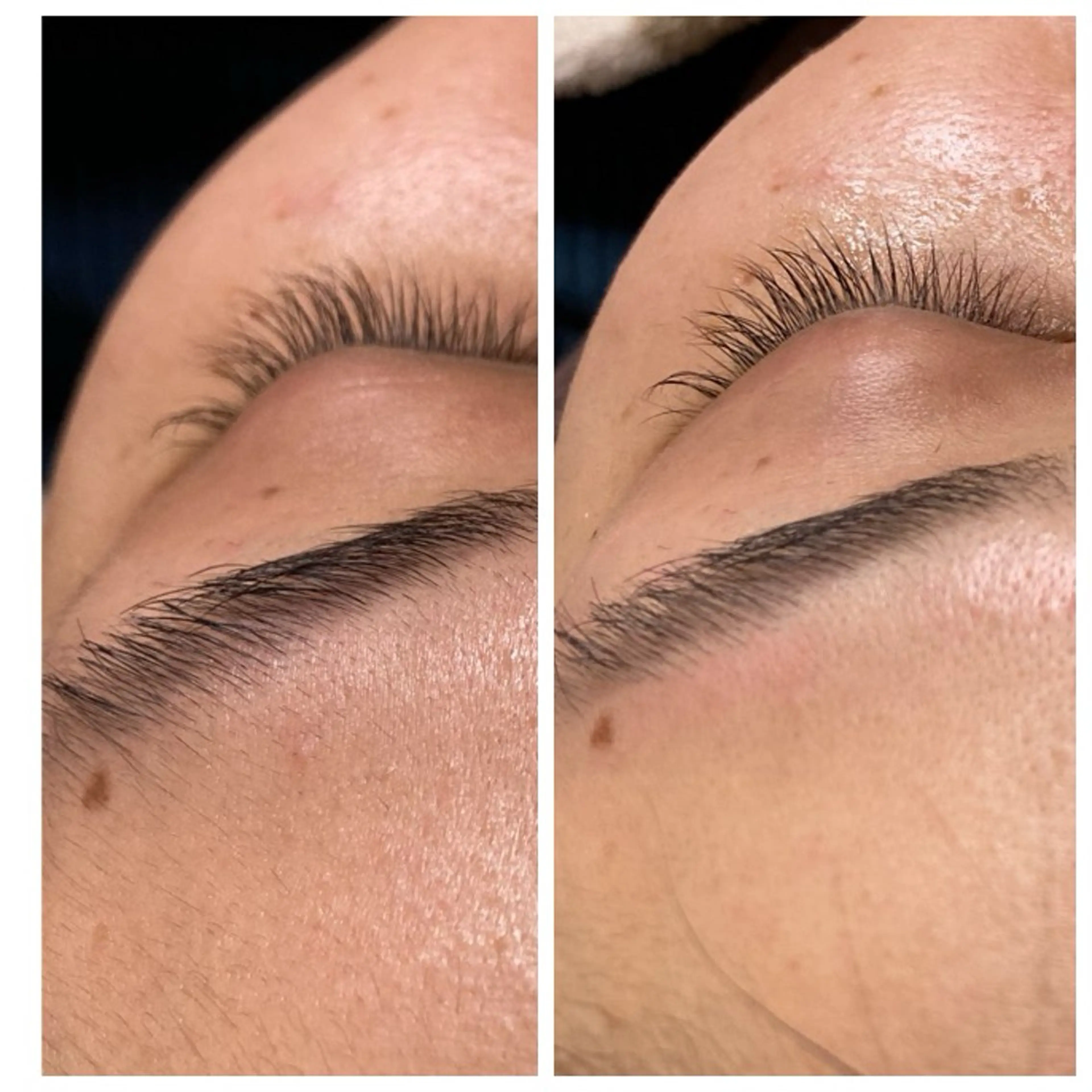 エステ 産毛専門店 Bittoのエステ・リラクイメージ