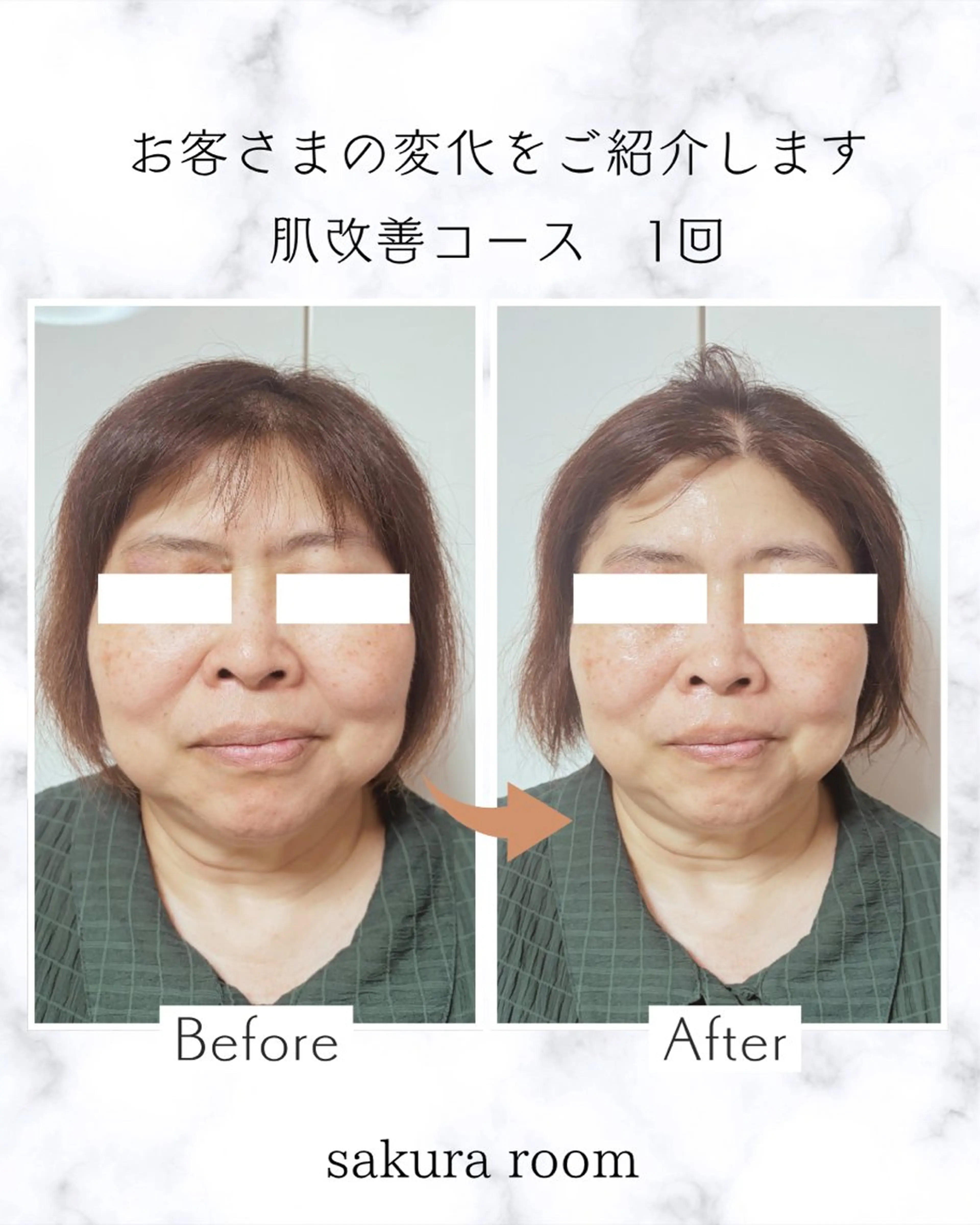 sakura room久我石原のエステ・リラクイメージ