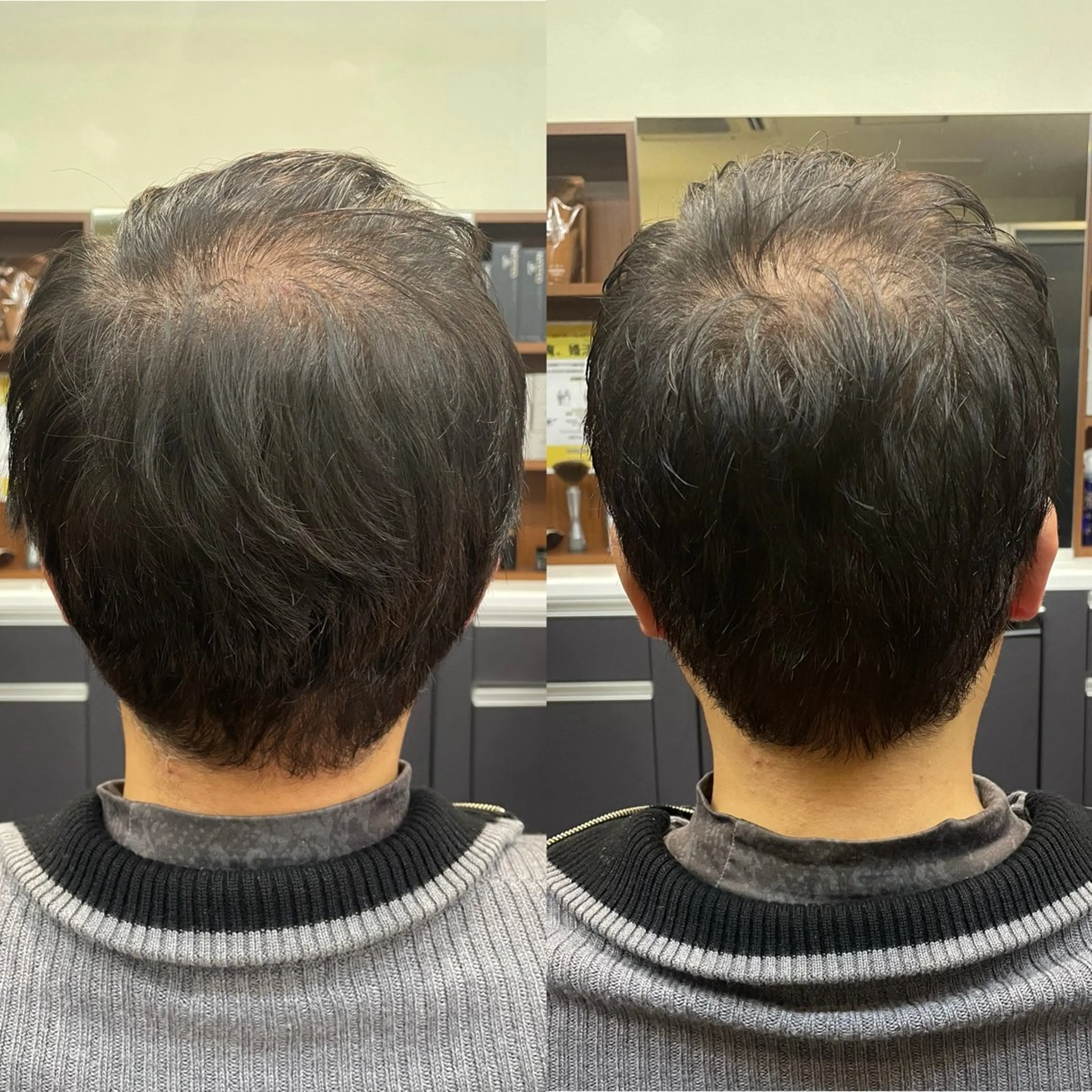 ショート メンズ トレサンパ所属・💈トレサンパ 💈金山駅✂︎愛実のヘアスタイル